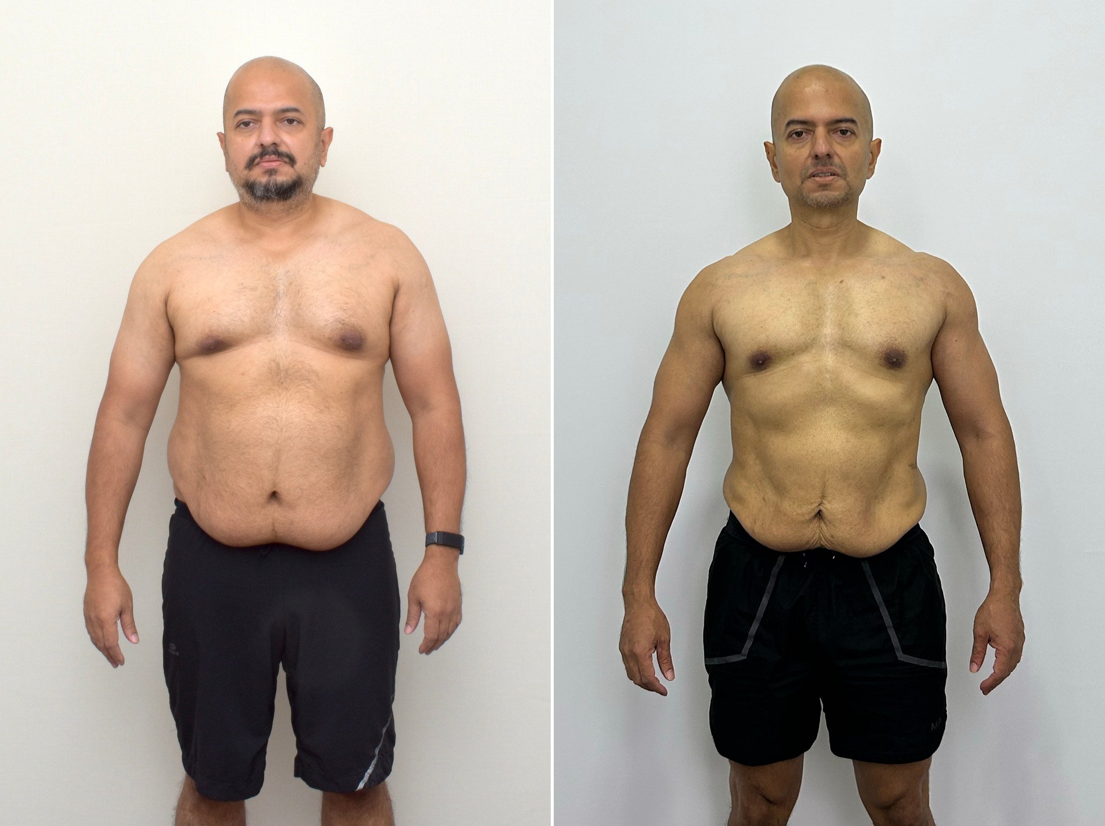 Avinash Gowda before he began losing weight a second time in January 2022 (above, left) and eight months later. Photo: Avinash Gowda