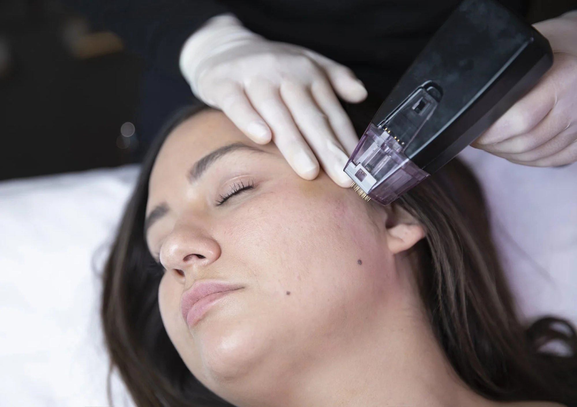 What is the Morpheus8 beauty treatment loved by celebrities? Kim ...