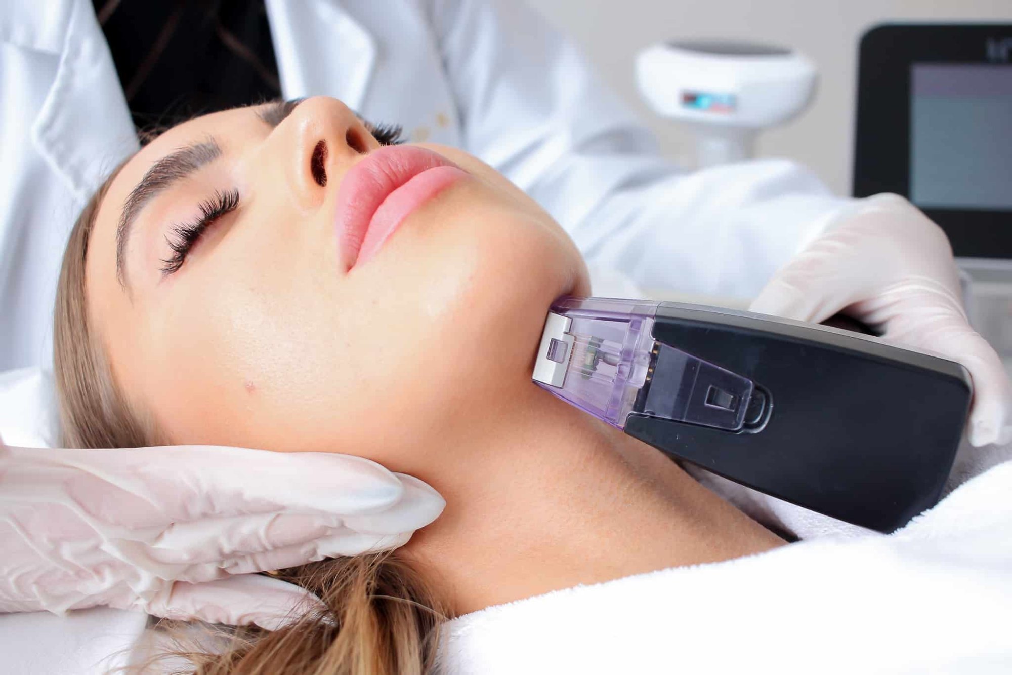 What is the Morpheus8 beauty treatment loved by celebrities? Kim ...