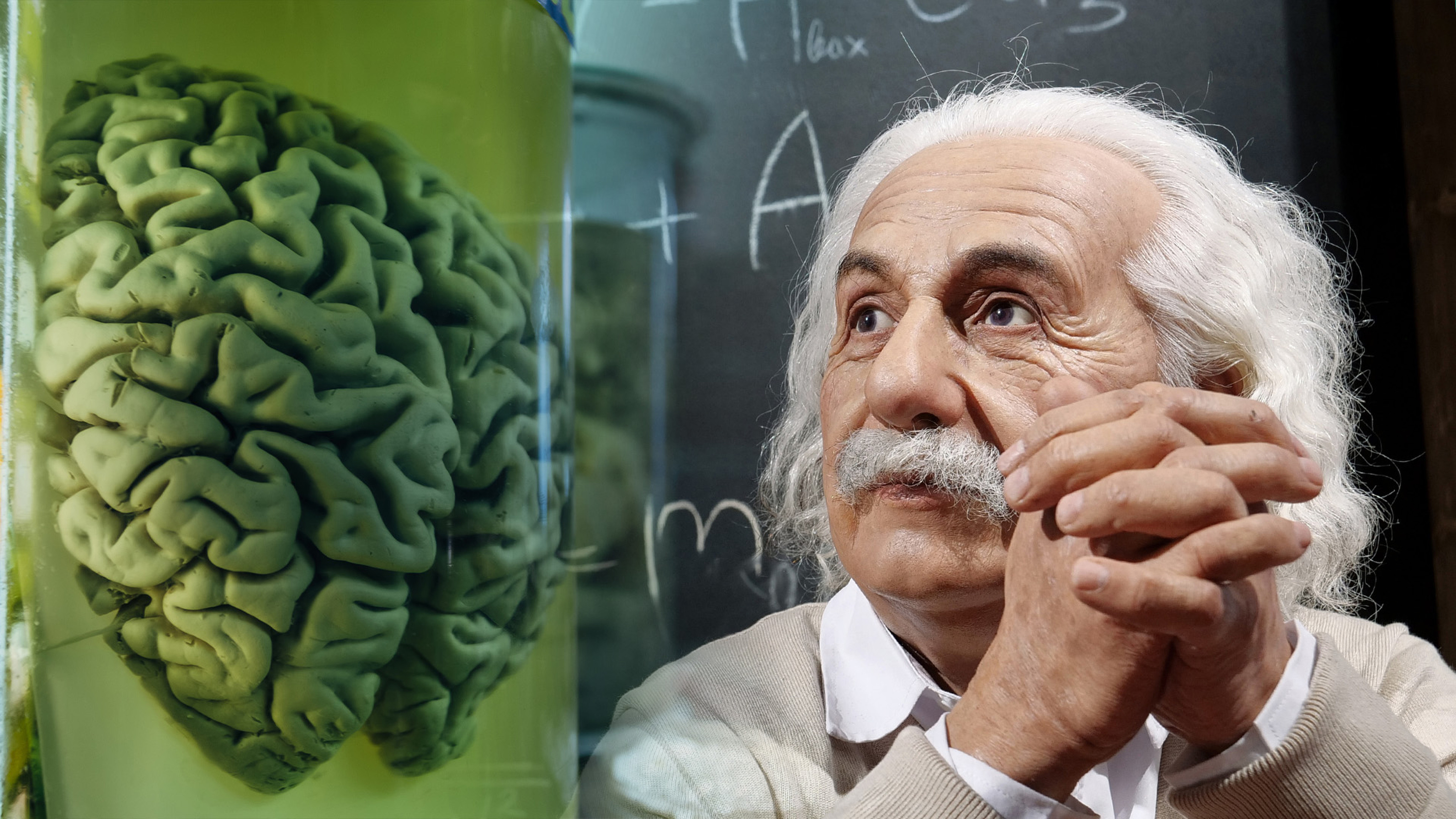 Albert Einstein Real Brain The Mystery Of Albert Einstein s Stolen