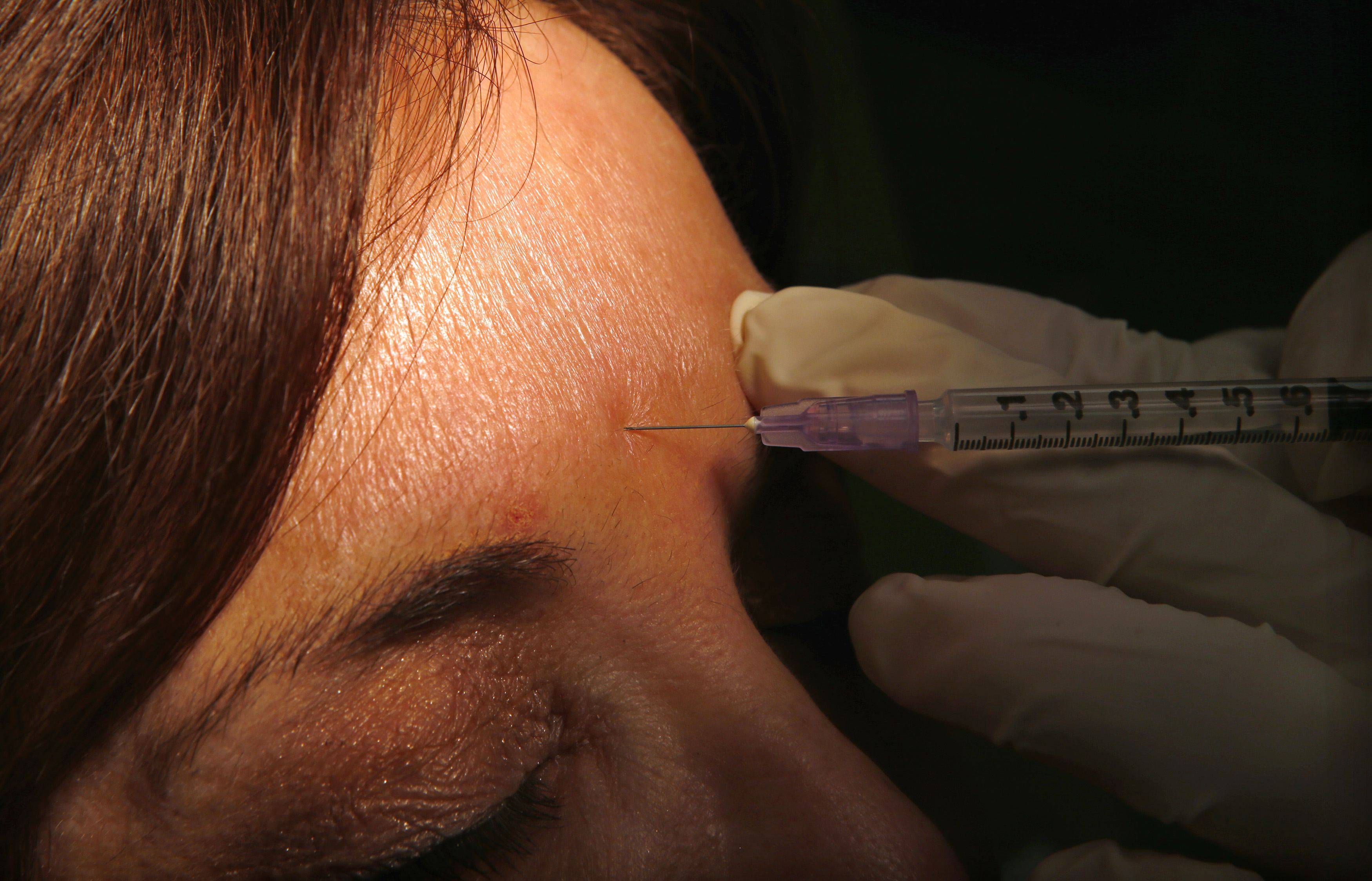 A woman gets an anti-wrinkle injection. Singapore authorities are investigating a case of a woman who became blind after being injected with a dermal filler. Photo: Reuters 