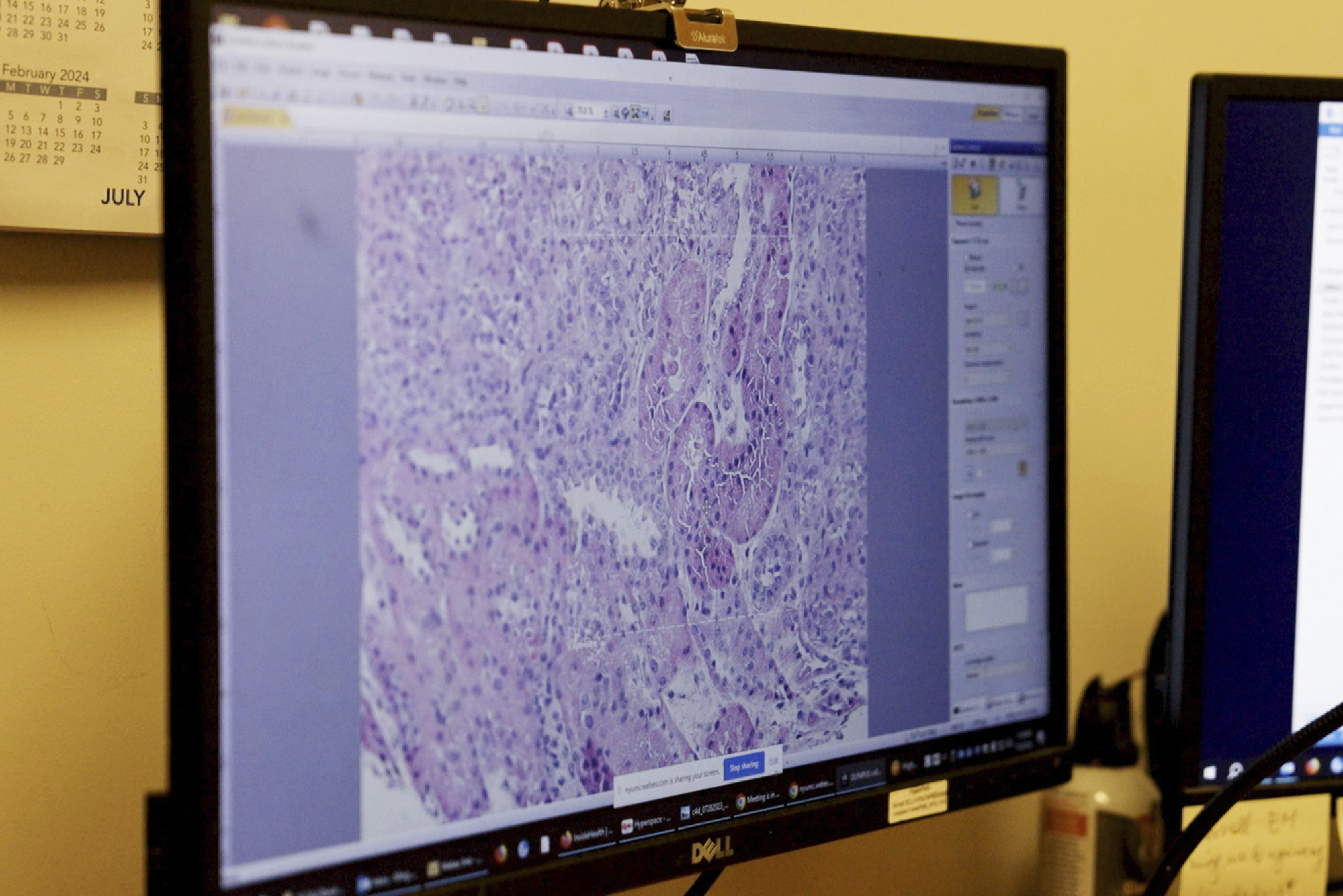 Researchers are racing to learn how to use animal organs to save human lives. Photo: AP