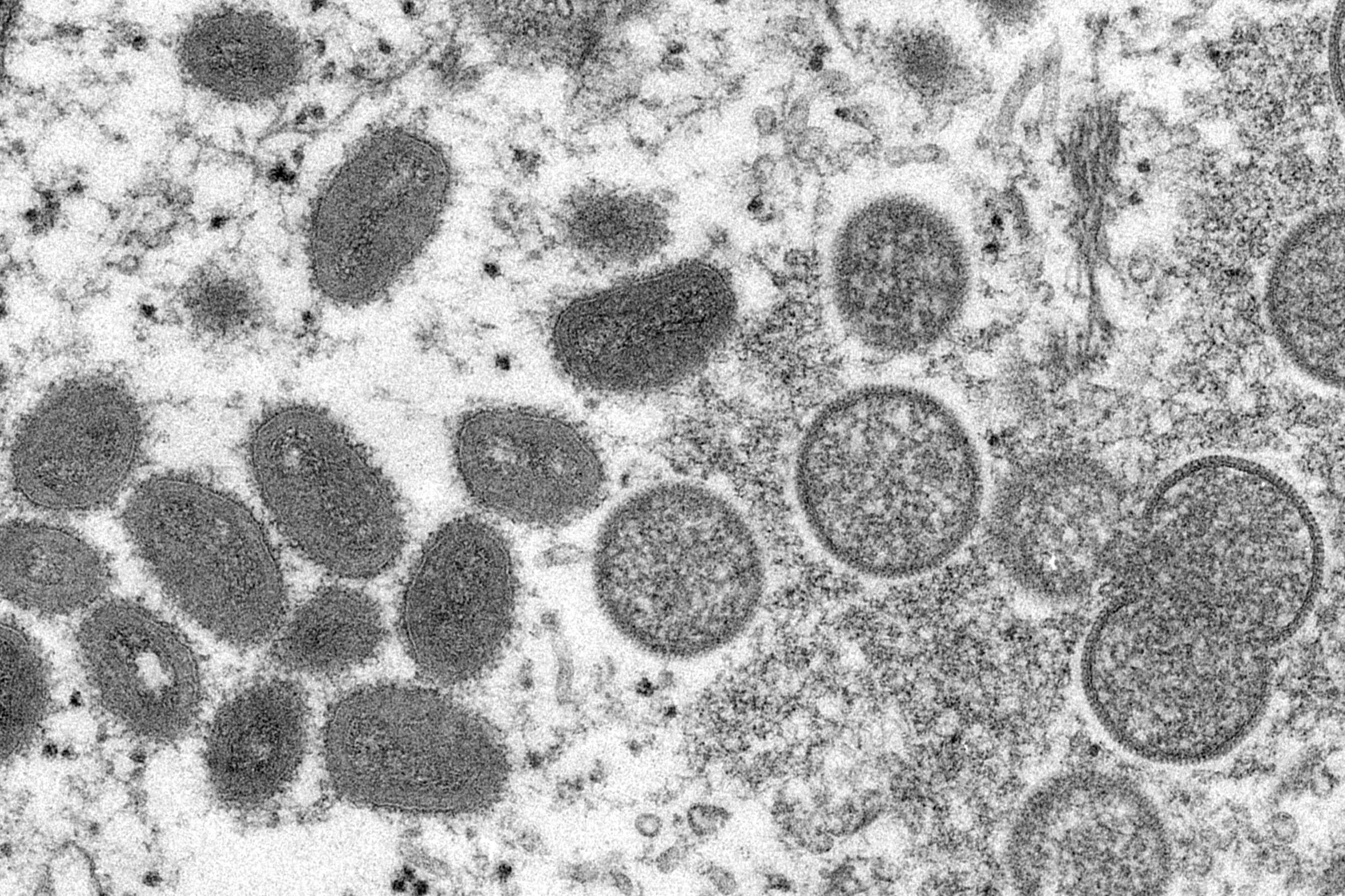 Mpox, shown here in an electron microscope image, has a low fatality rate, but case numbers on the rise in China. Photo: AP