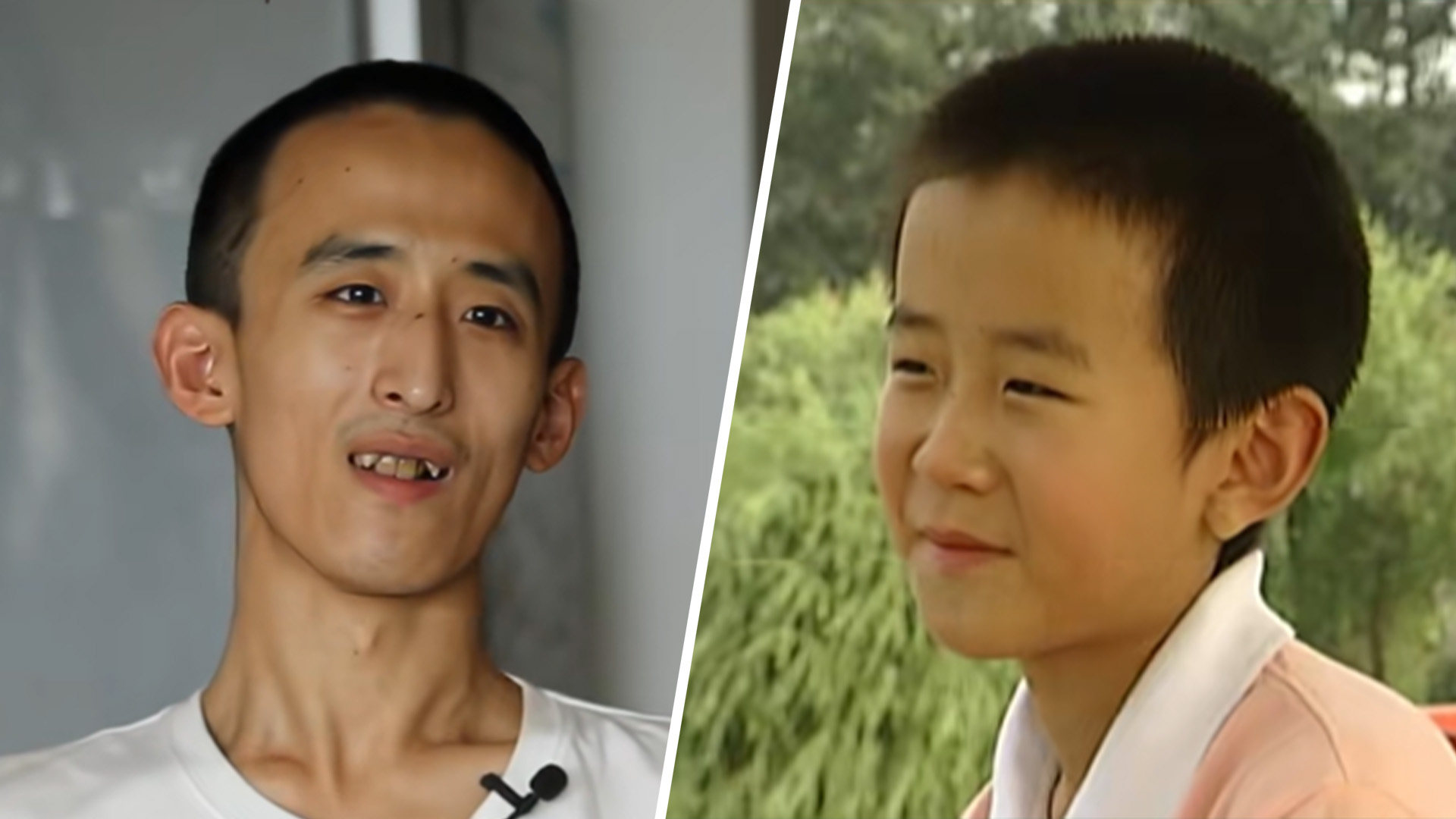 Zhang Xinyang, 28, a Chinese prodigy who won a university place at age 10, now believes “sitting around and doing nothing is the key to lifelong happiness”. Photo: SCMP composite/Douyin