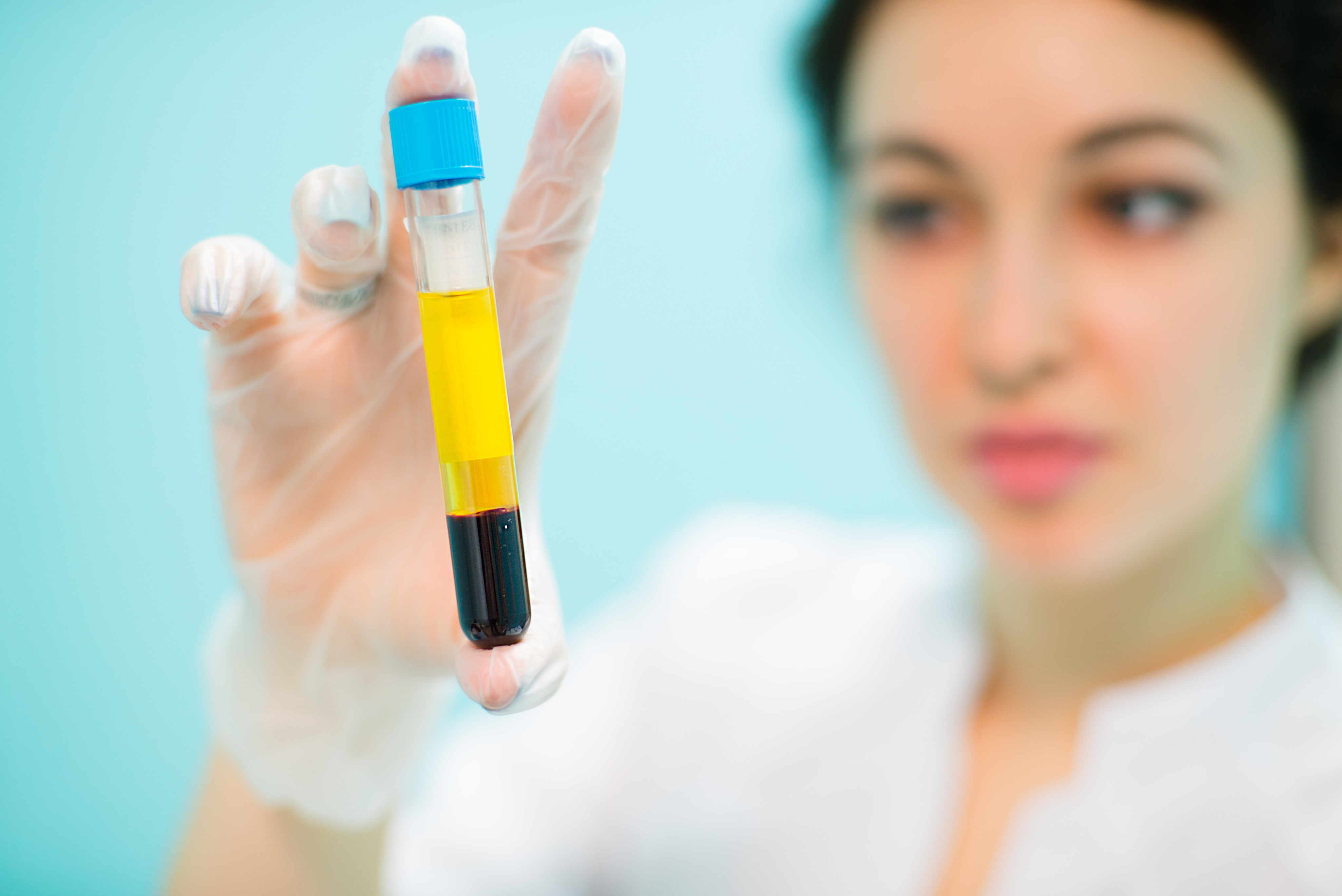 New blood tests developed in Hong Kong and the US deliver an easier, less invasive and more cost-effective way to detect Alzheimer’s disease early. Photo: Shutterstock