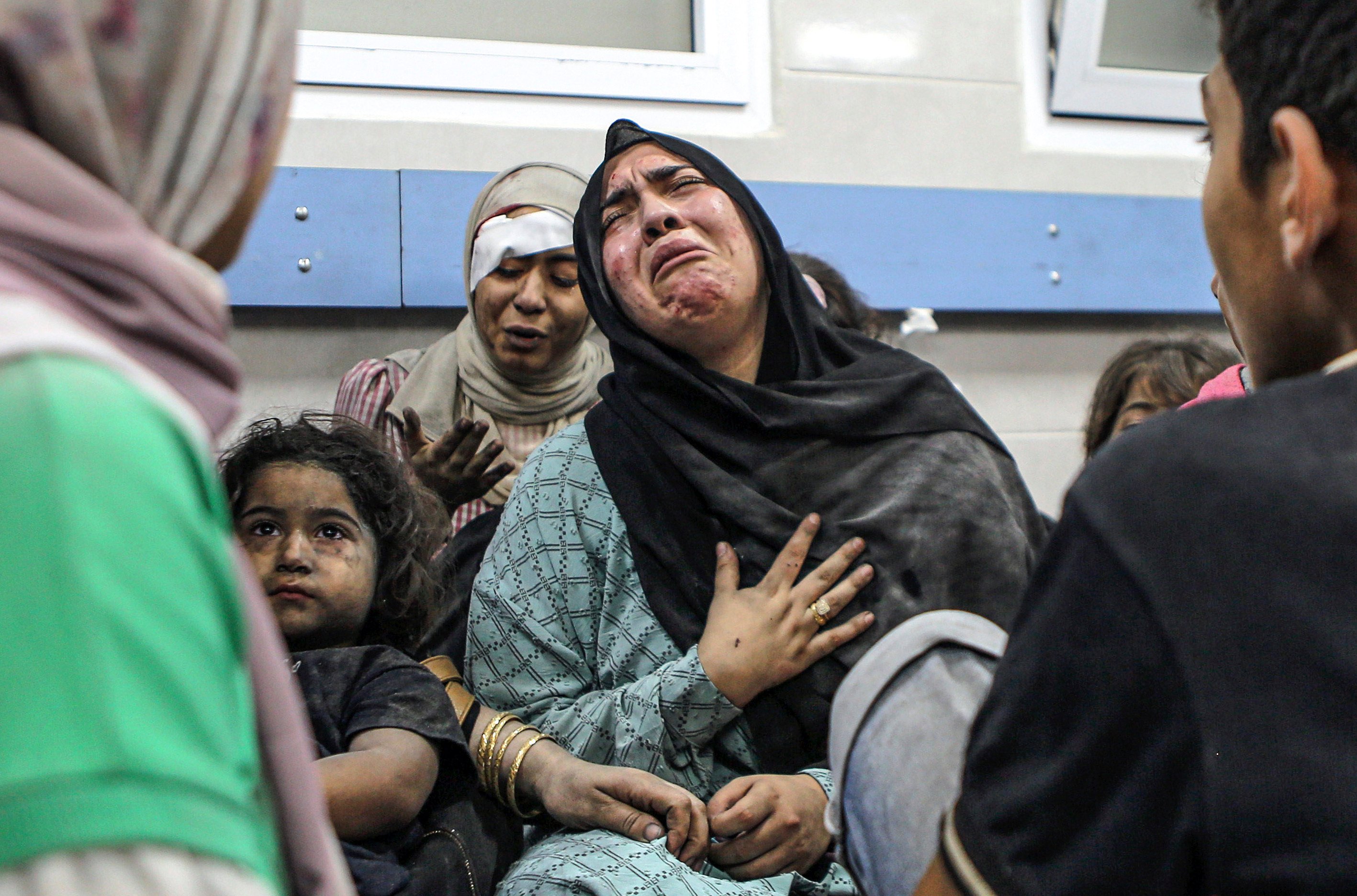 Wounded Palestinians at the al-Shifa hospital in Gaza City, after arriving from al-Ahli hospital following an explosion there that killed hundreds. Photo: AP