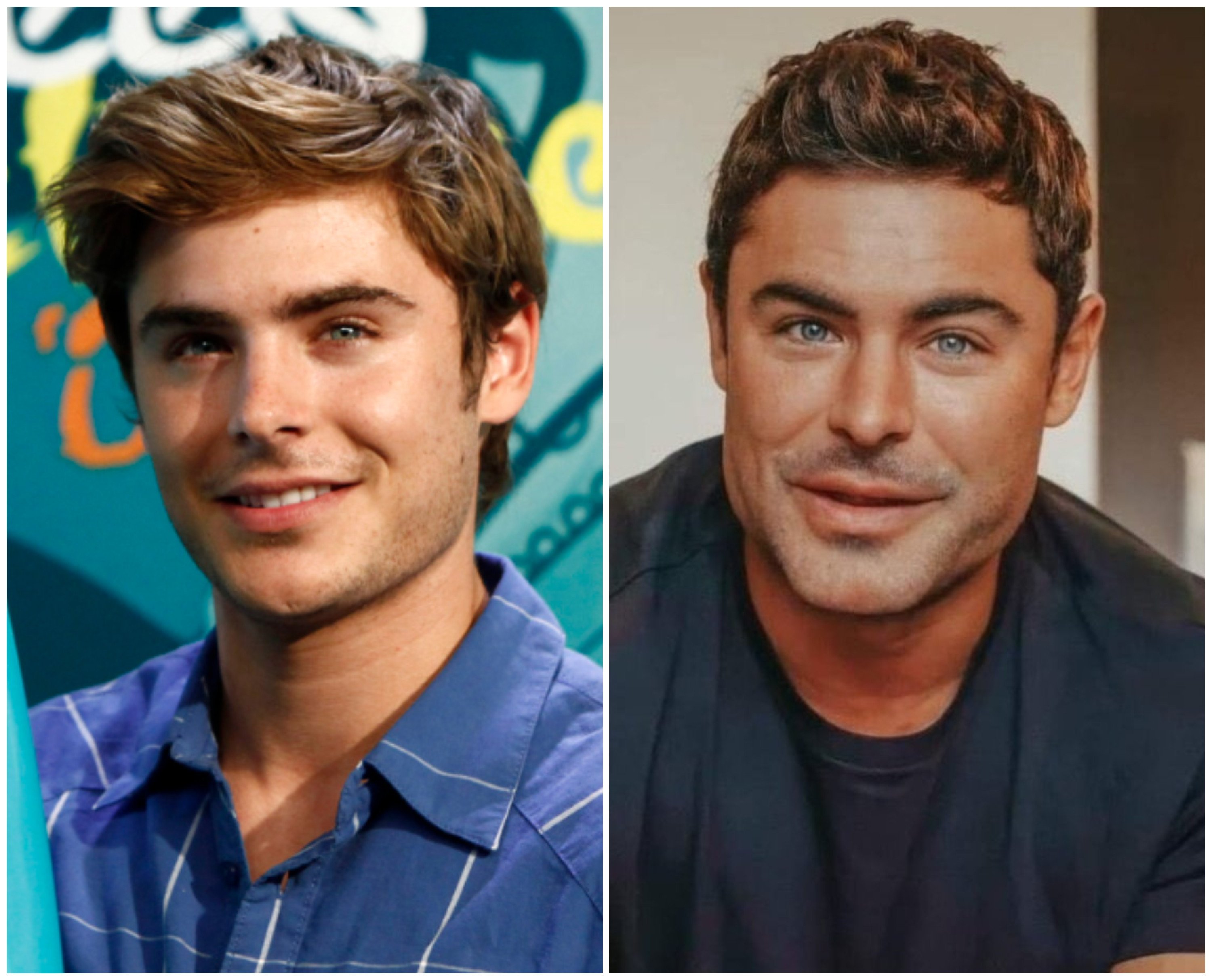 Zac Efron went viral for his noticeably larger jaw last year – and now the rumours are back. Photos: AP, @pazzeskamilan0/X