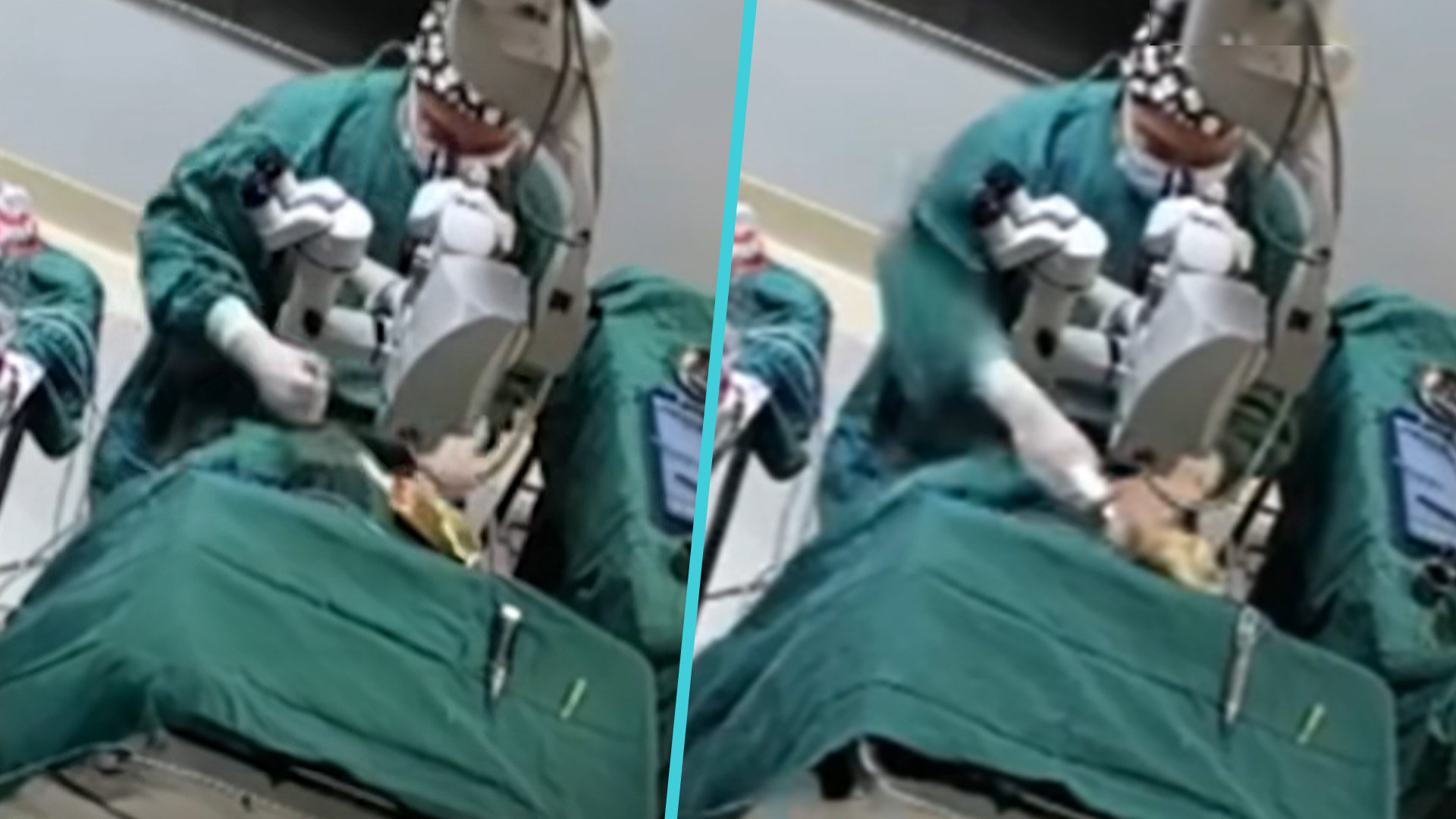 An eye doctor in China has been suspended from his position pending an official probe after fresh details went viral online of an incident in which he punched an 82-year-old woman patient in the head mid-surgery. Photo: SCMP composite/Douyin