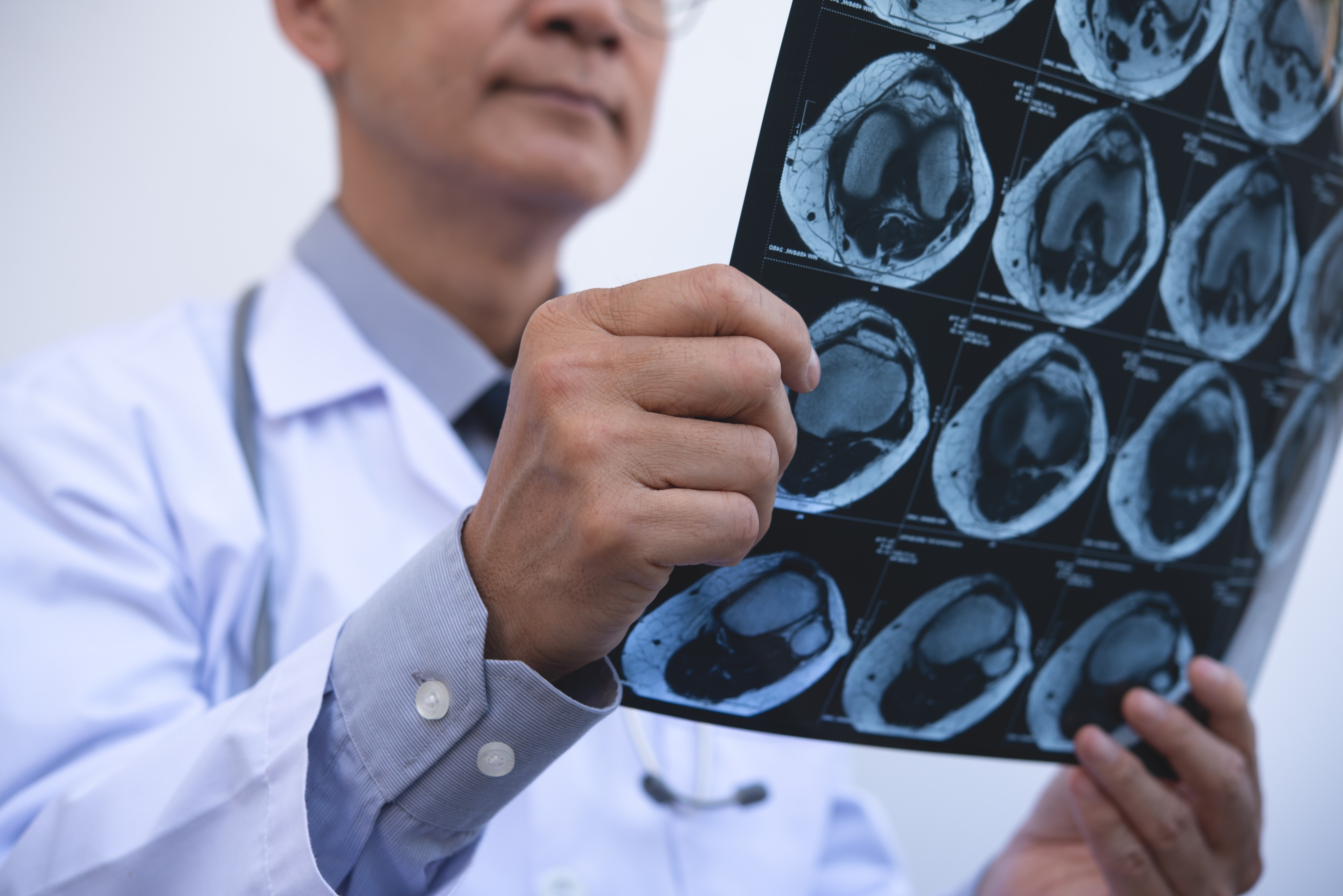 A Chinese team reports it has built a powerful “Flash” system that can deliver extremely high energy radiation. It could mean fewer treatment sessions to cancer patients. Photo: Shutterstock