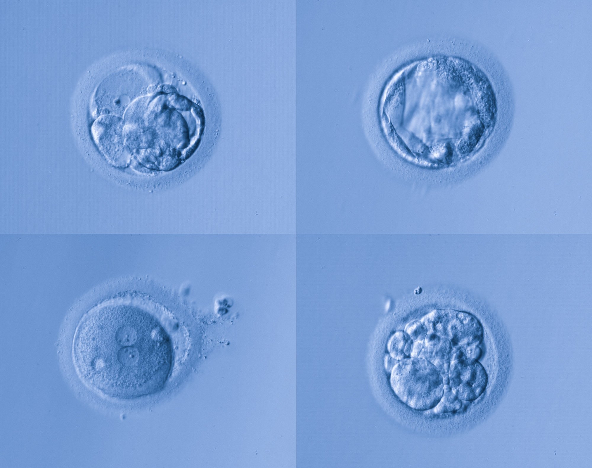 Human egg cells. Scientists are debating when it is ethically acceptable to use an embryo in scientific research. Photo: Shutterstock