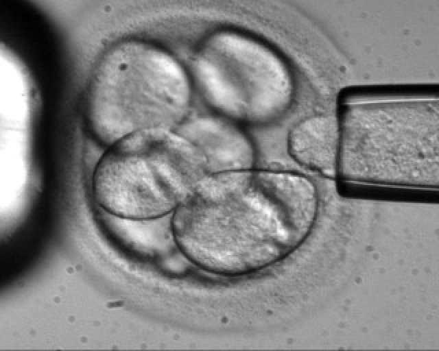 A single cell is removed from a human embryo to be used in generating embryonic stem cells for scientific research. Photo: Advanced Cell Technology/AP