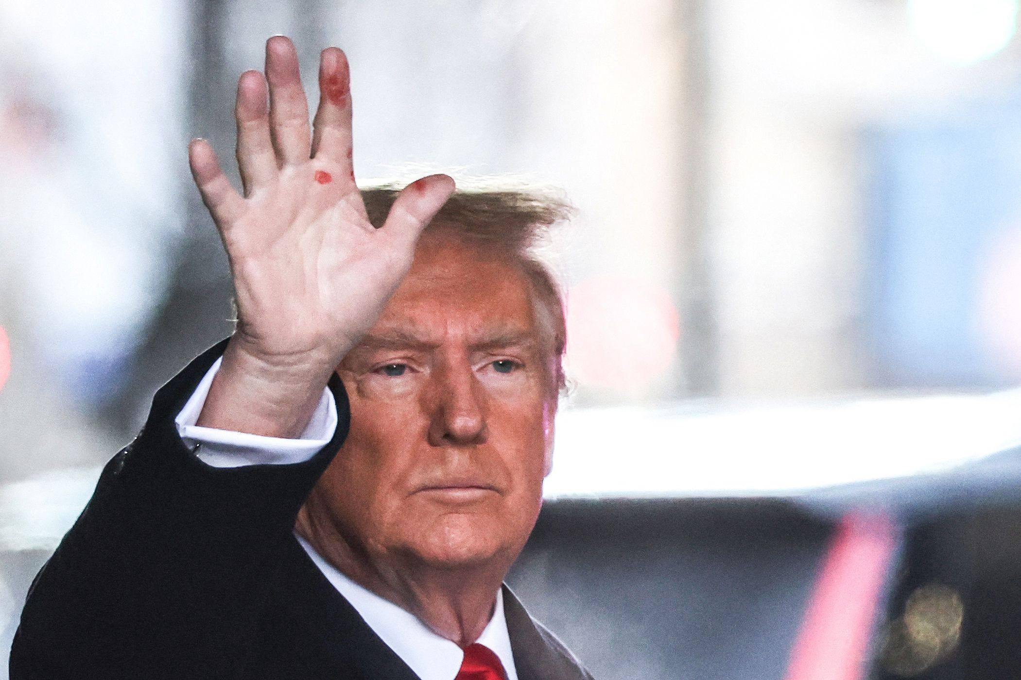 Donald Trump waves to the crowd outside Trump Tower on Tuesday. Red marks are clearly visible on his hand. Photo: AFP