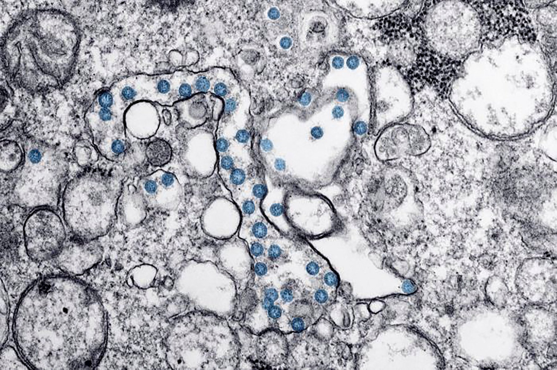 A microscopic image from February 2020, provided by the US Centres for Disease Control and Prevention, shows an isolate from the first US case of Covid-19. Photo: US Centres for Disease Control and Prevention via AFP