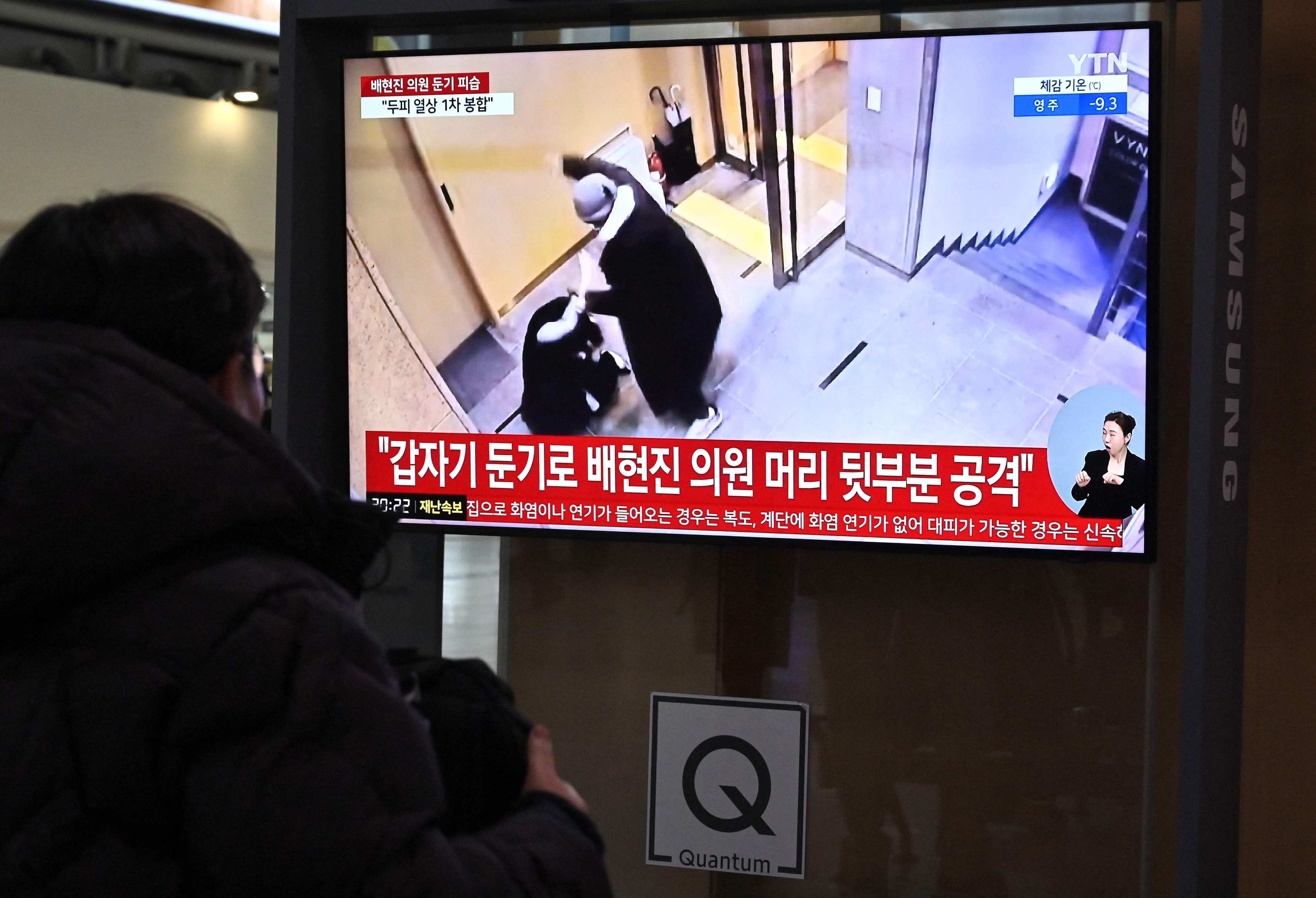 A man watches a news broadcast showing footage of the scene where South Korean ruling People Power Party’s lawmaker Bae Hyun-jin being assaulted. Photo: AFP