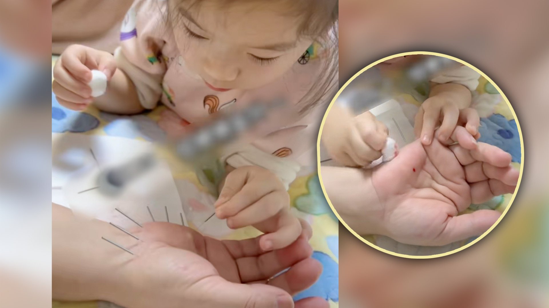 A five-year-old girl in China has stunned mainland social media by learning to practice Traditional Chinese Medicine acupuncture, and more, from her grandmother. Photo: SCMP composite/Douyin