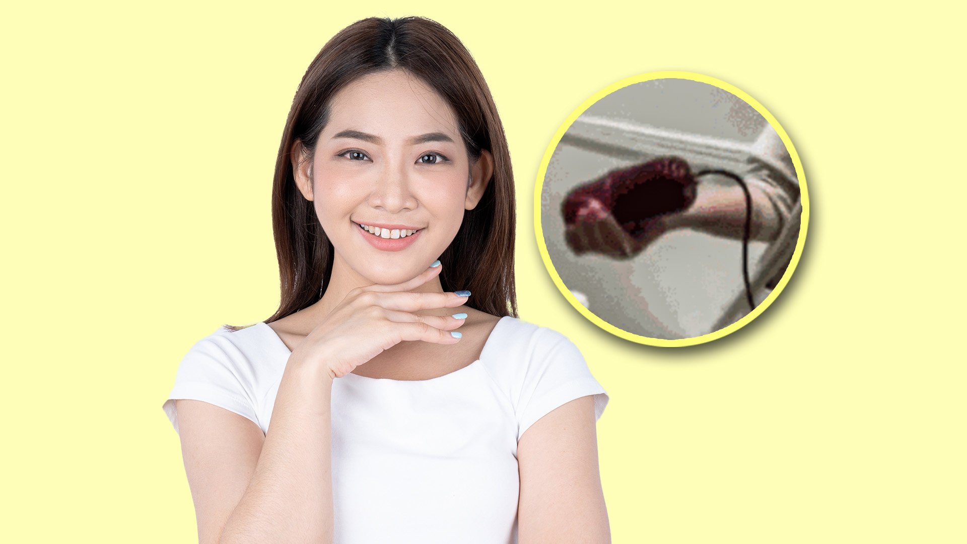 A new “blood purification” beauty treatment in China which involves the extraction and re-injection of plasma has raised health fears among experts and faced criticism on mainland social media. Photo: SCMP composite/Shutterstock/The Paper
