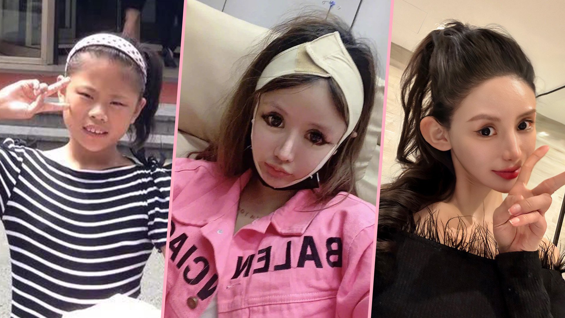 A teenager in China who has splurged US$563,000 of her parents’ money on plastic surgery in a bid to look like her favourite actress has been warned 
by experts that one more operation could kill her. Photo: SCMP composite/Weibo