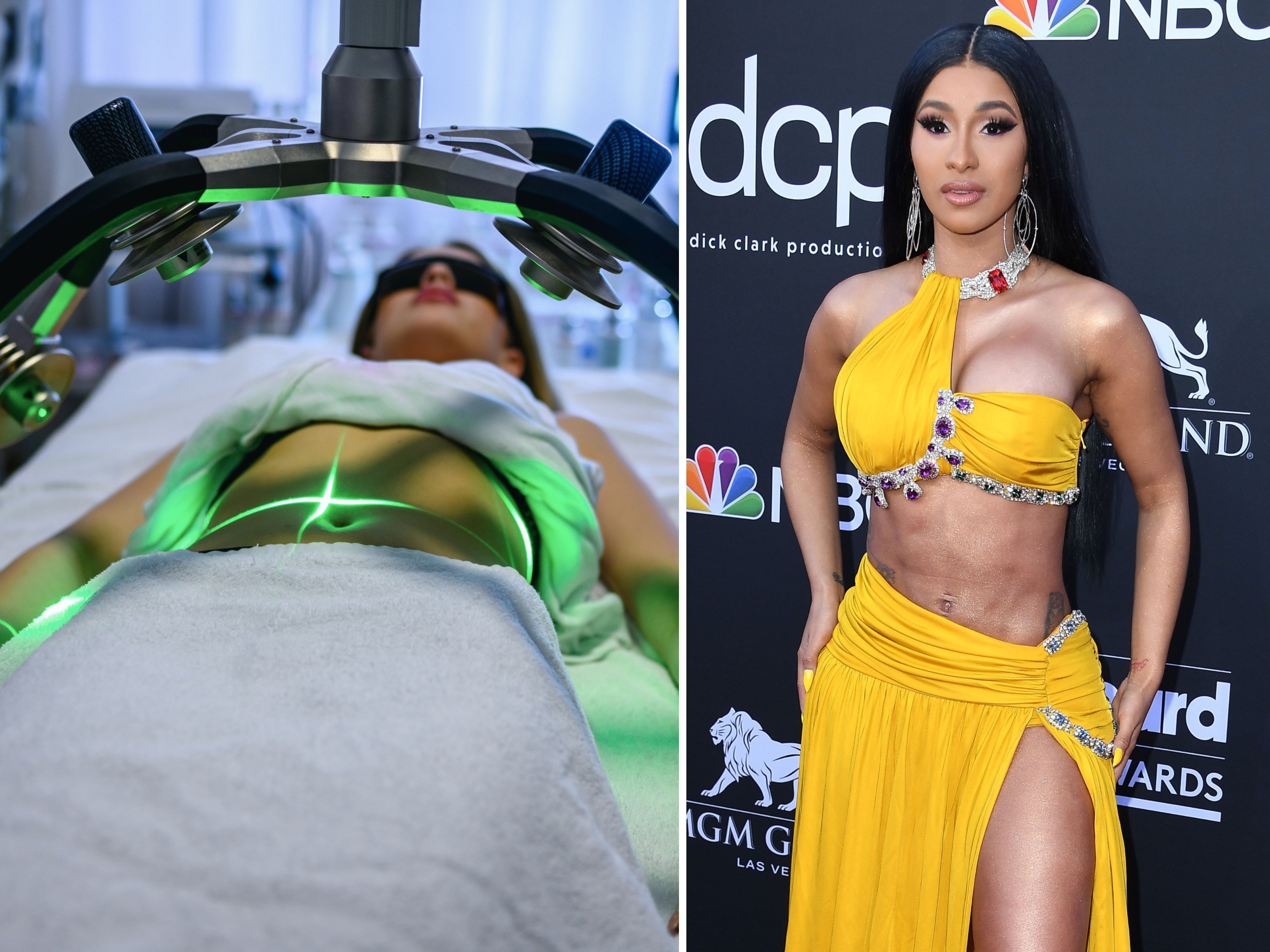 Cardi B initially denied getting liposuction but later opened up about the surgery. Photo: Getty Images