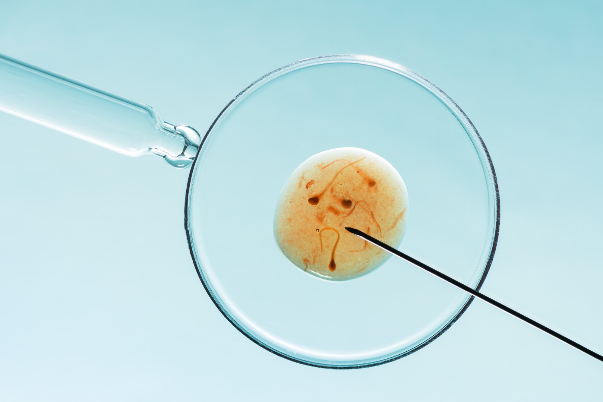 In vitro fertilisation concept. The current age limit for individuals receiving IVF treatment is 40 at public healthcare providers. Photo: Shutterstock