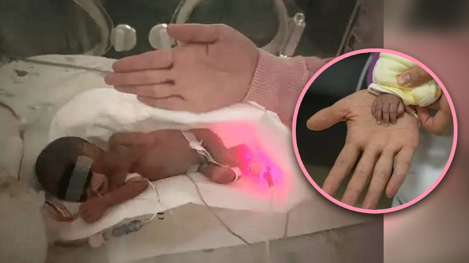 A premature baby girl in China, who was born no bigger than the size of an adult hand, has been discharged from hospital after 112 days of intensive care. Photo: SCMP composite/Baidu/Weibo