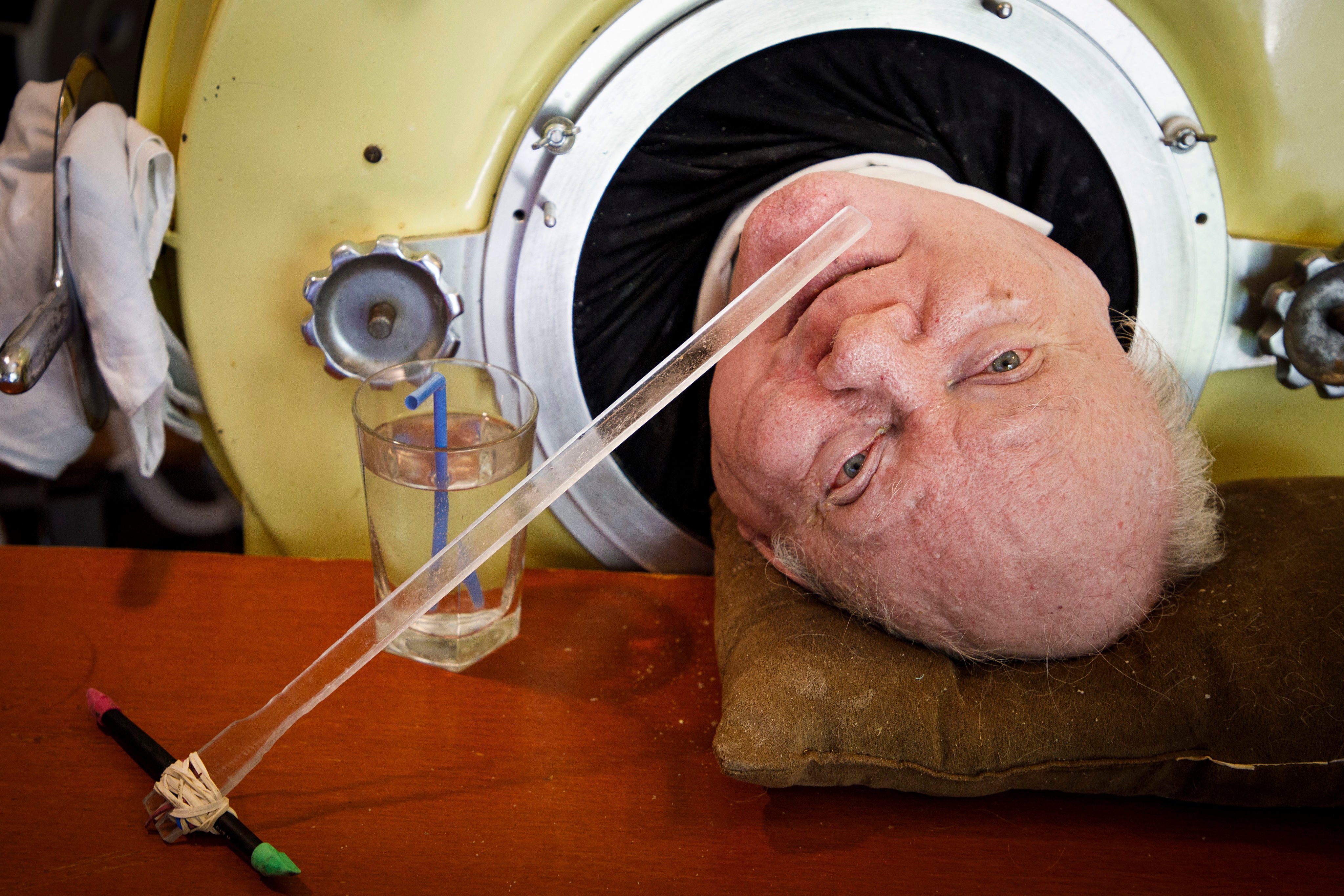 Paul Alexander looks out from inside his iron lung at his home in Dallas, Texas, in April 2018. Photo: The Dallas Morning News via AP