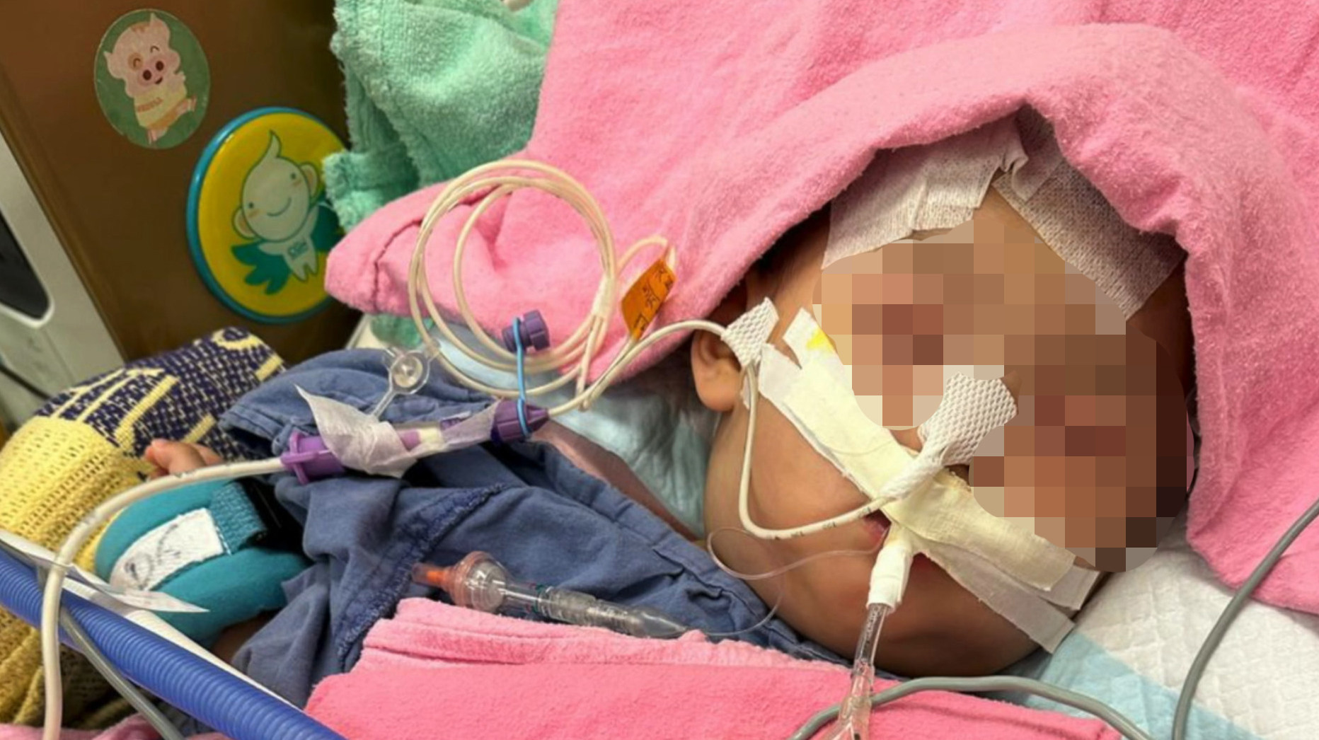 The parents of a baby who suffered serious brain injuries in January say she faces a life-threatening operation. Facebook / @(Catherine Lui )