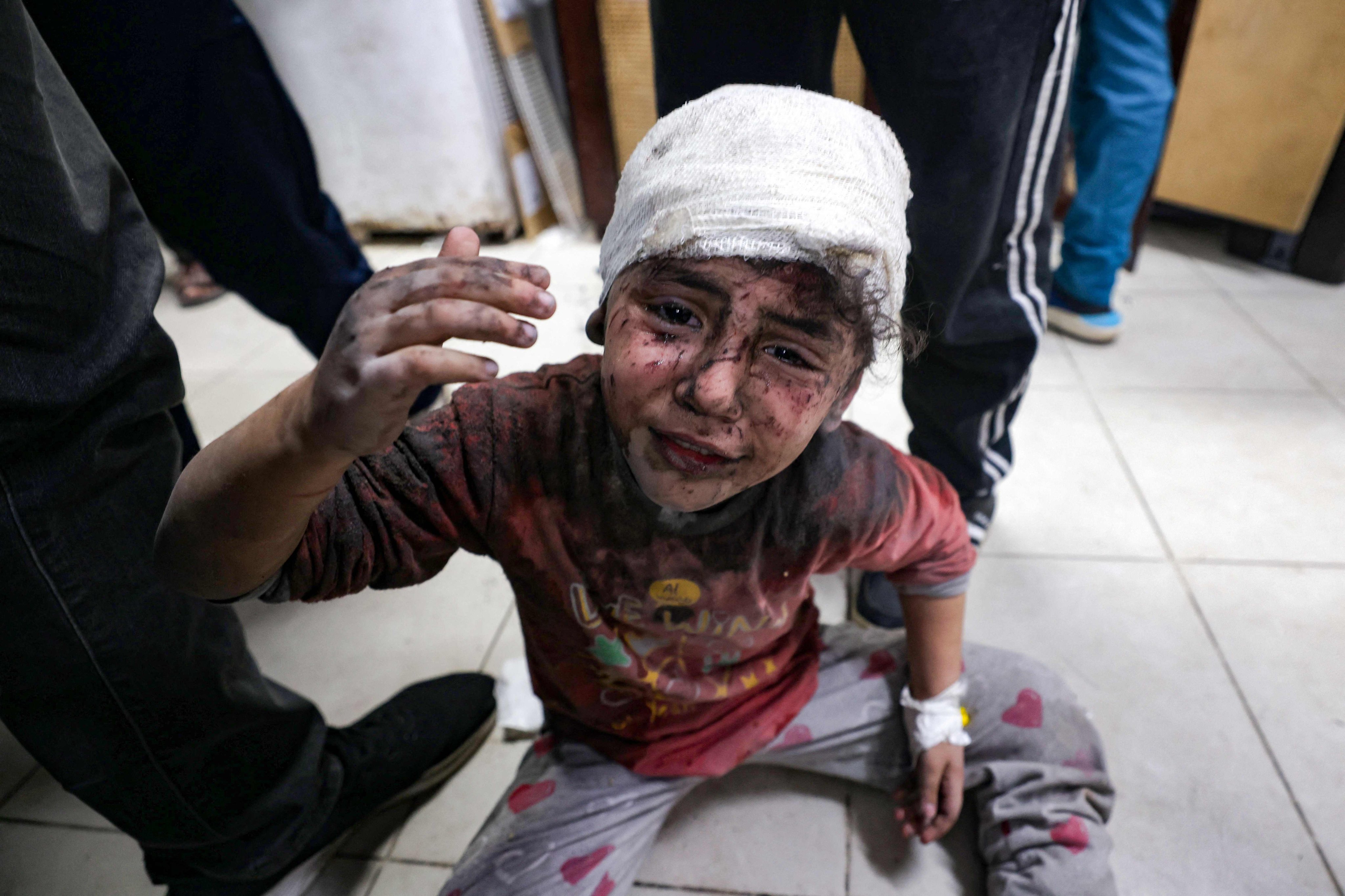 A child injured during Israel’s bombardment of Gaza sits on the floor at the al-Najjar hospital in Rafah in the southern Gaza Strip on Sunday. Mediators are trying to work out a truce in the war that has raged for more than five months. Photo: AFP