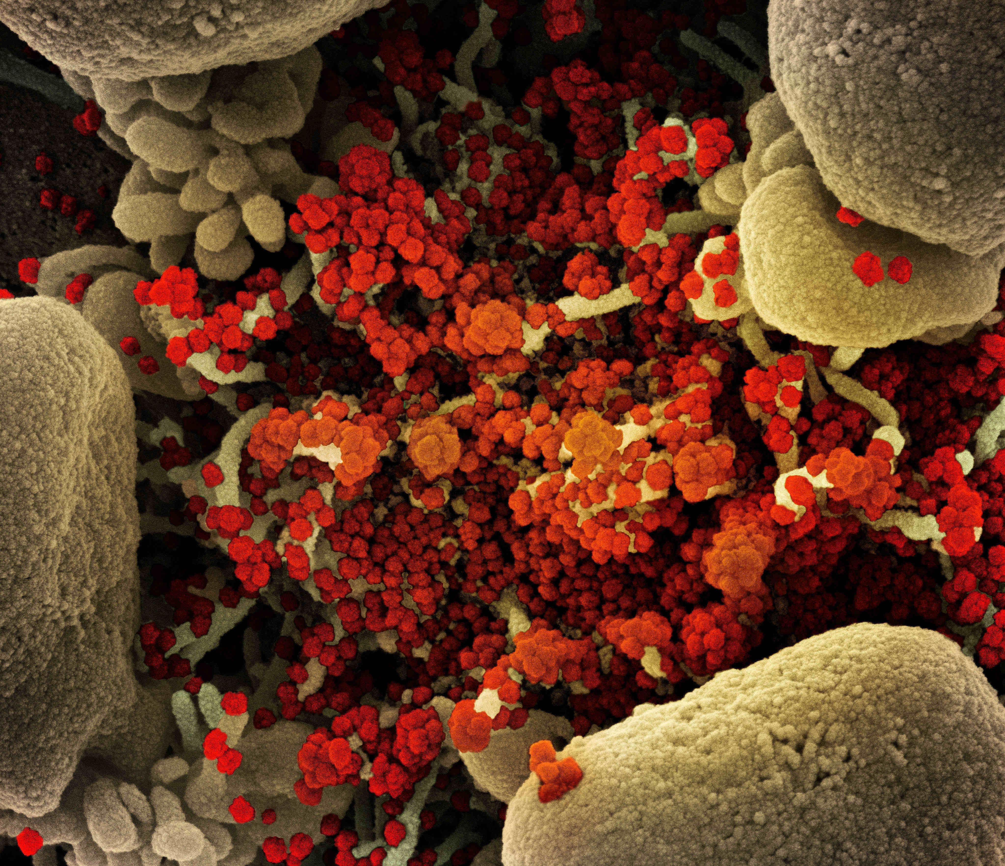 Coronavirus particles are seen in a scanning electron micrograph of a heavily infected cell. Image: NIAID via TNS