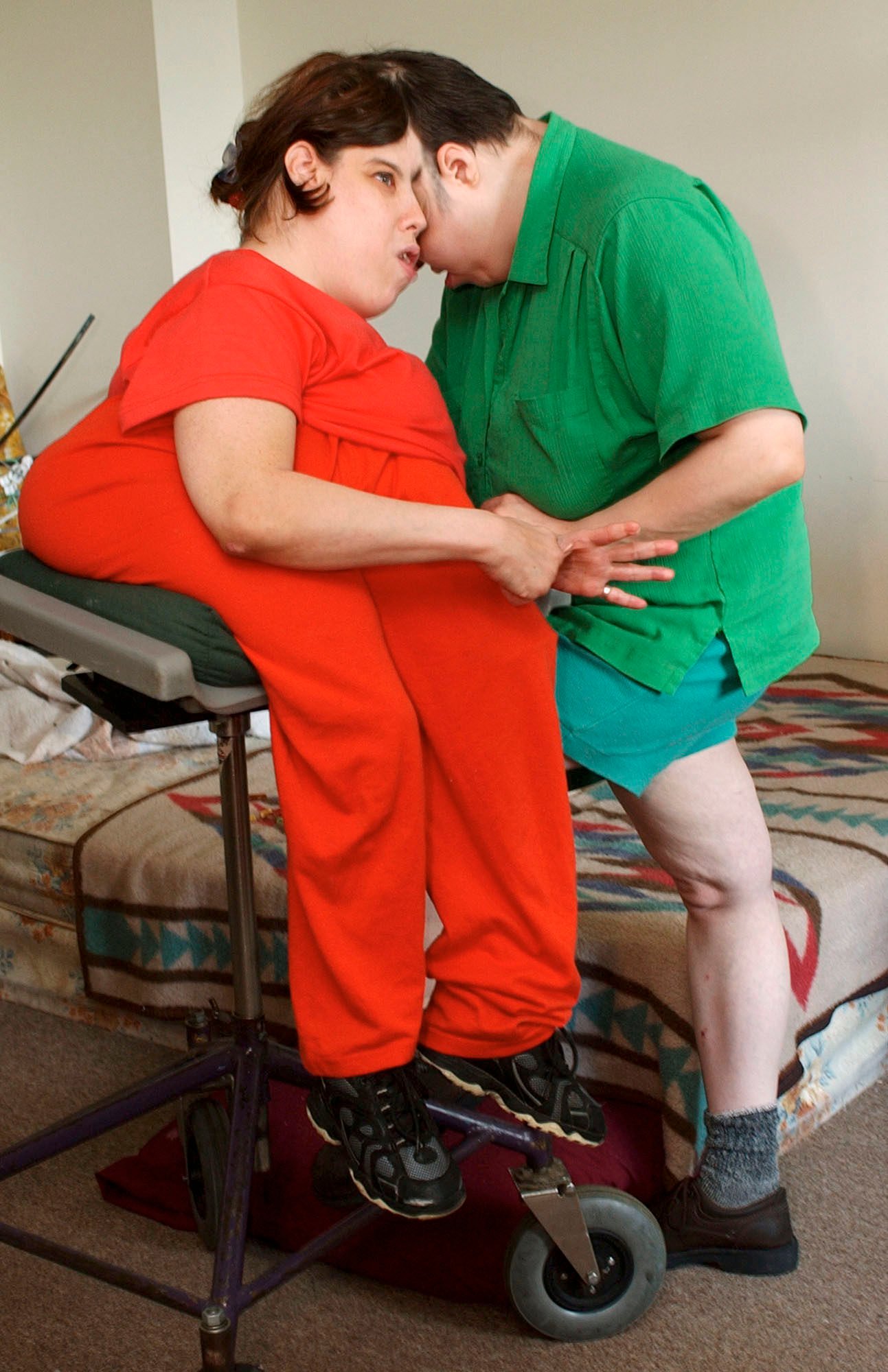Lori and George Schappell were the oldest living conjoined twins as per the Guinness World Records. Photo: AP