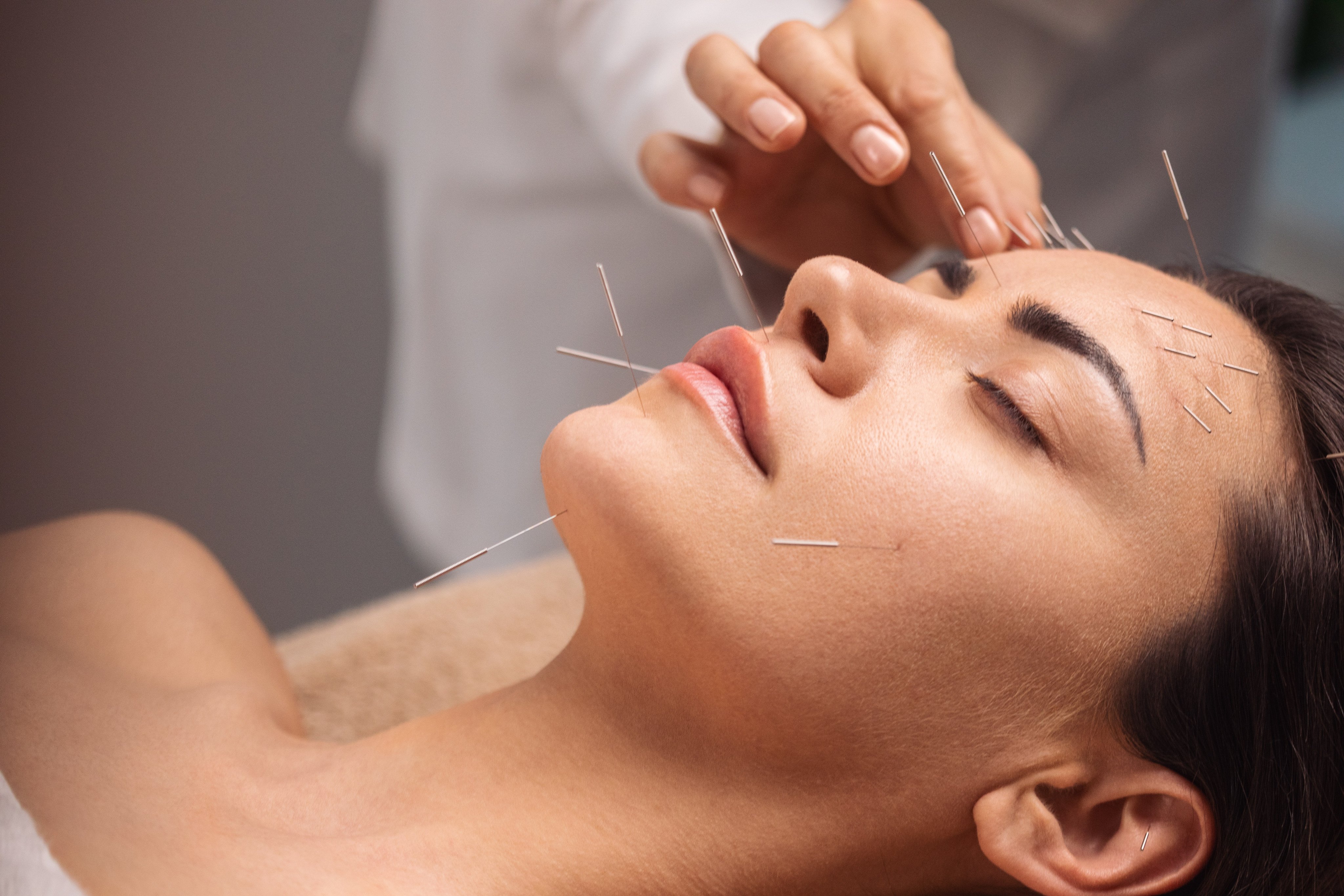 Cosmetic acupuncture is gaining popularity as people turn to a gentler and more holistic approach towards anti-ageing. Photo: Getty Images