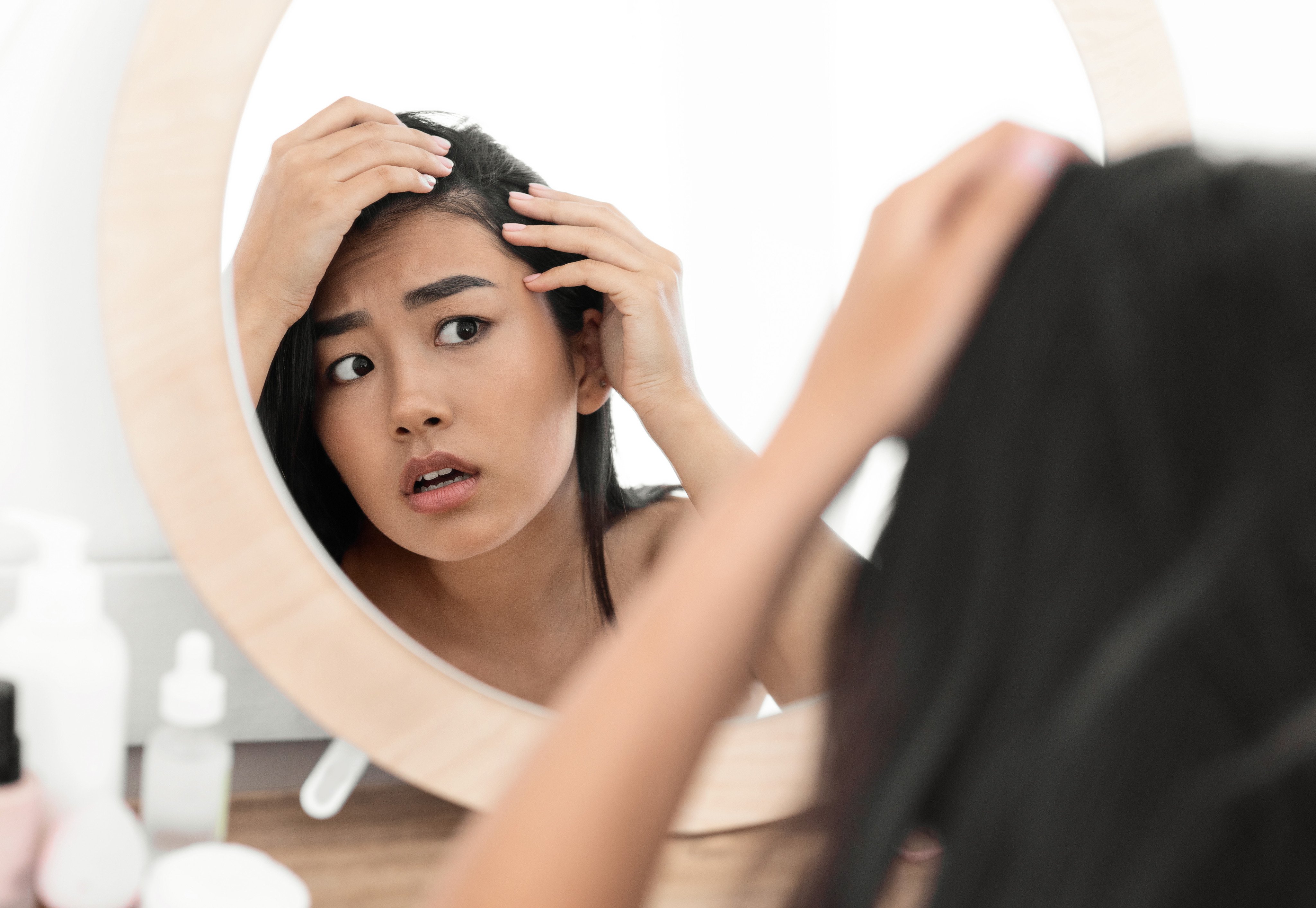 Hair issues afflict one in six people in China, and a new AI-powered feature on Alipay is promises to help people self-assess whether they are balding. Photo: Shutterstock