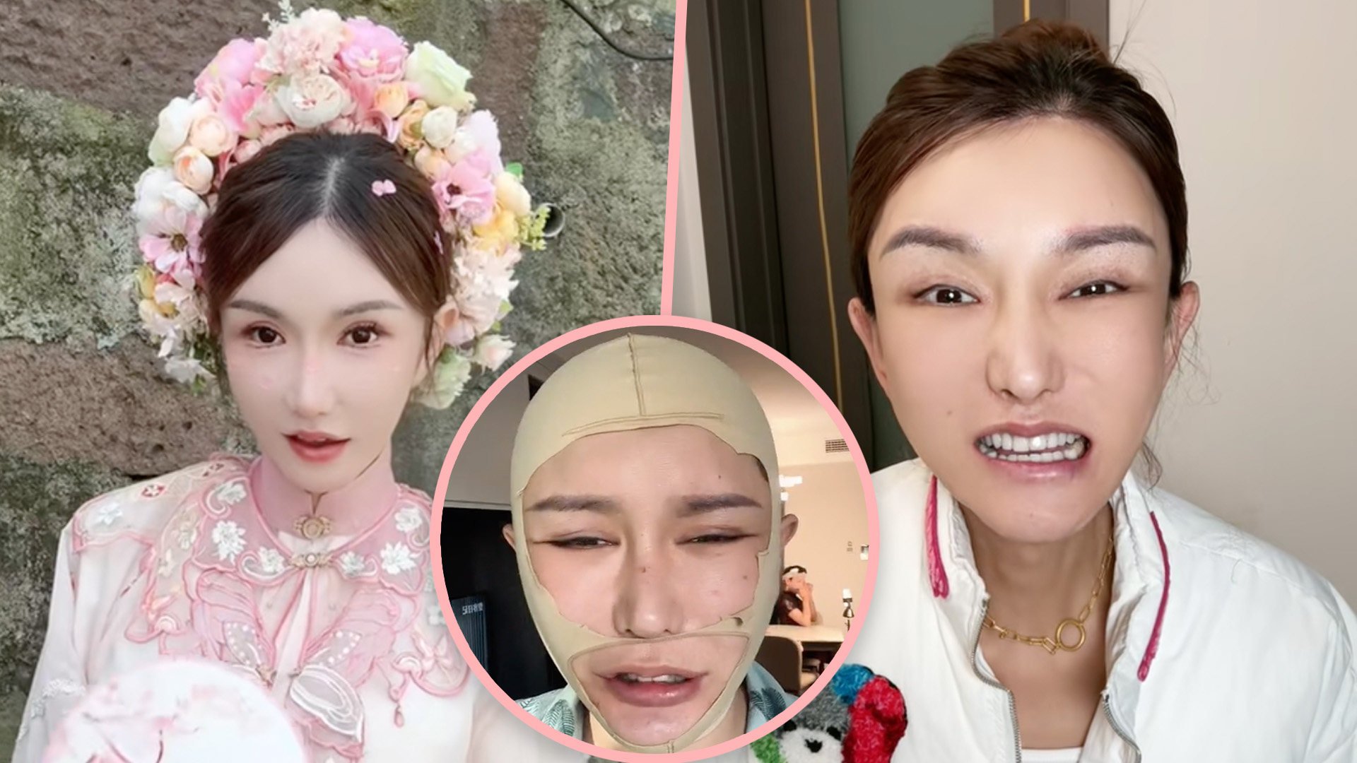 A transgender woman KOL in China has shocked her 2.2 million followers with deformities she suffered after botched plastic surgery which cost her US$183,000. Photo: SCMP composite/Douyin