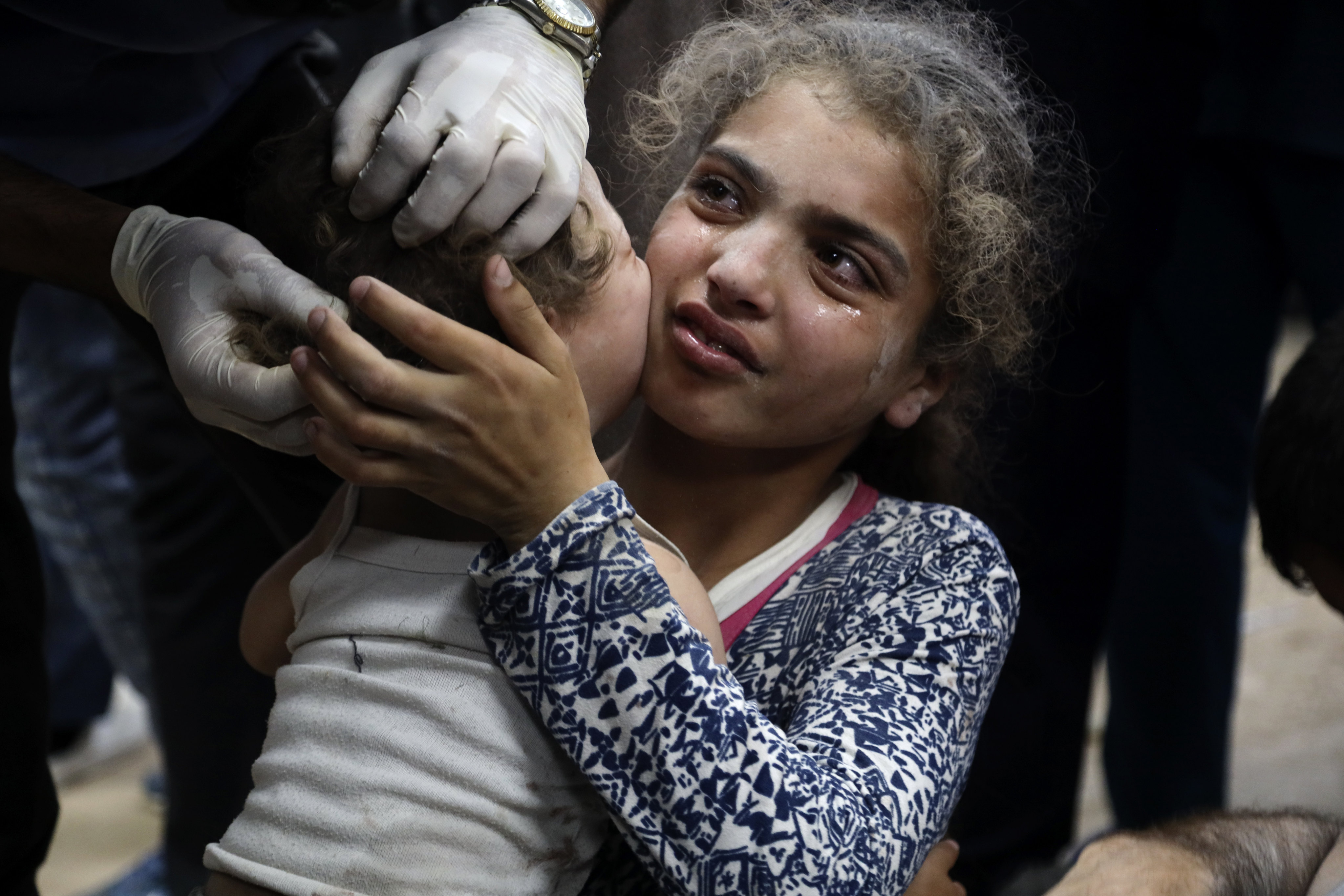 Palestinian children wounded in an Israeli bombardment in Gaza on June 4, 2024. Photo: AP