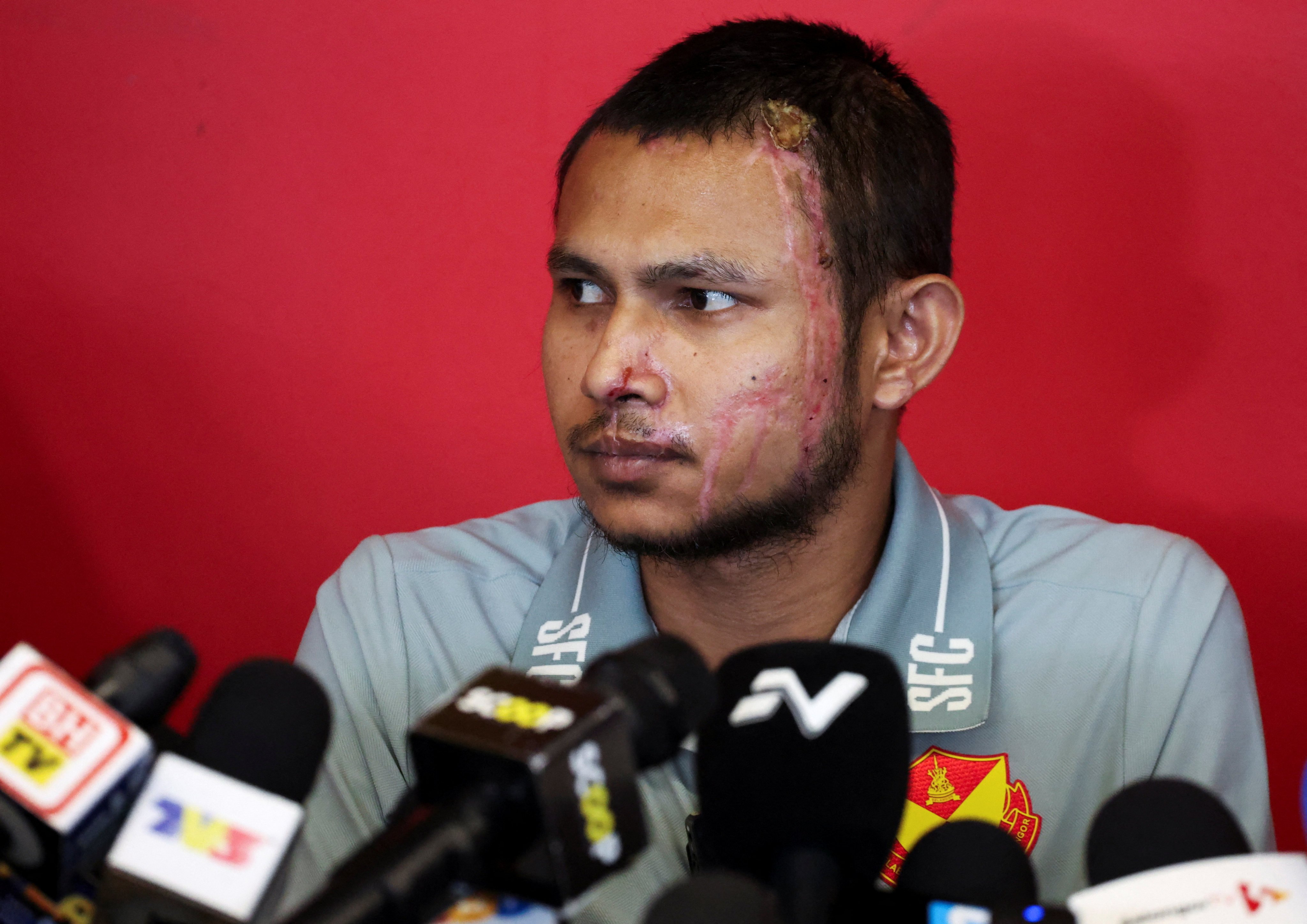 Malaysian footballer  Faisal Halim suffered fourth-degree burns in the acid attack at a shopping centre outside Kuala Lumpur. Photo: Reuters