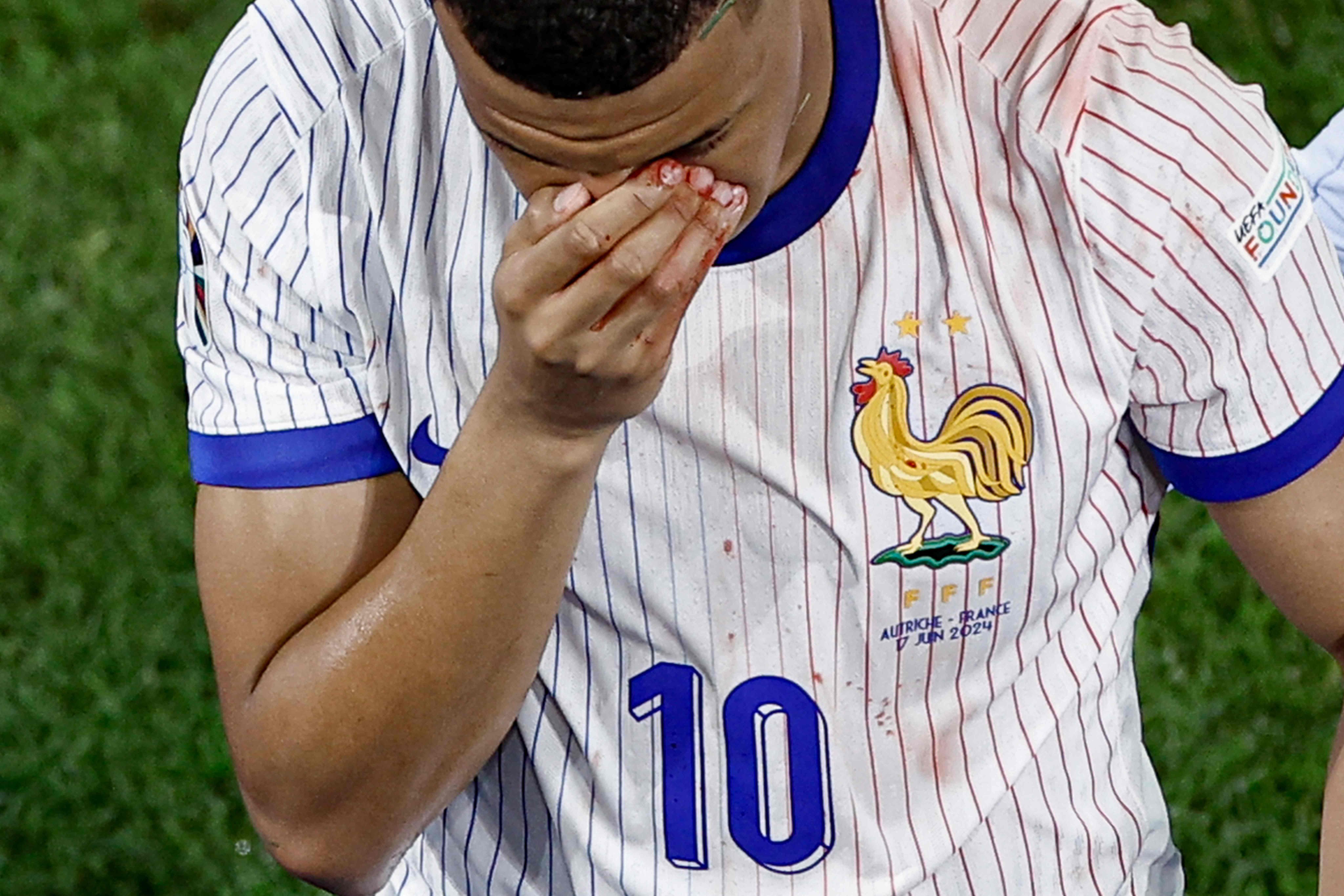 France’s Kylian Mbappe leaves the pitch after breaking his nose in a collision during the Group D match against Austria in Duesseldorf on Monday. Photo: AFP