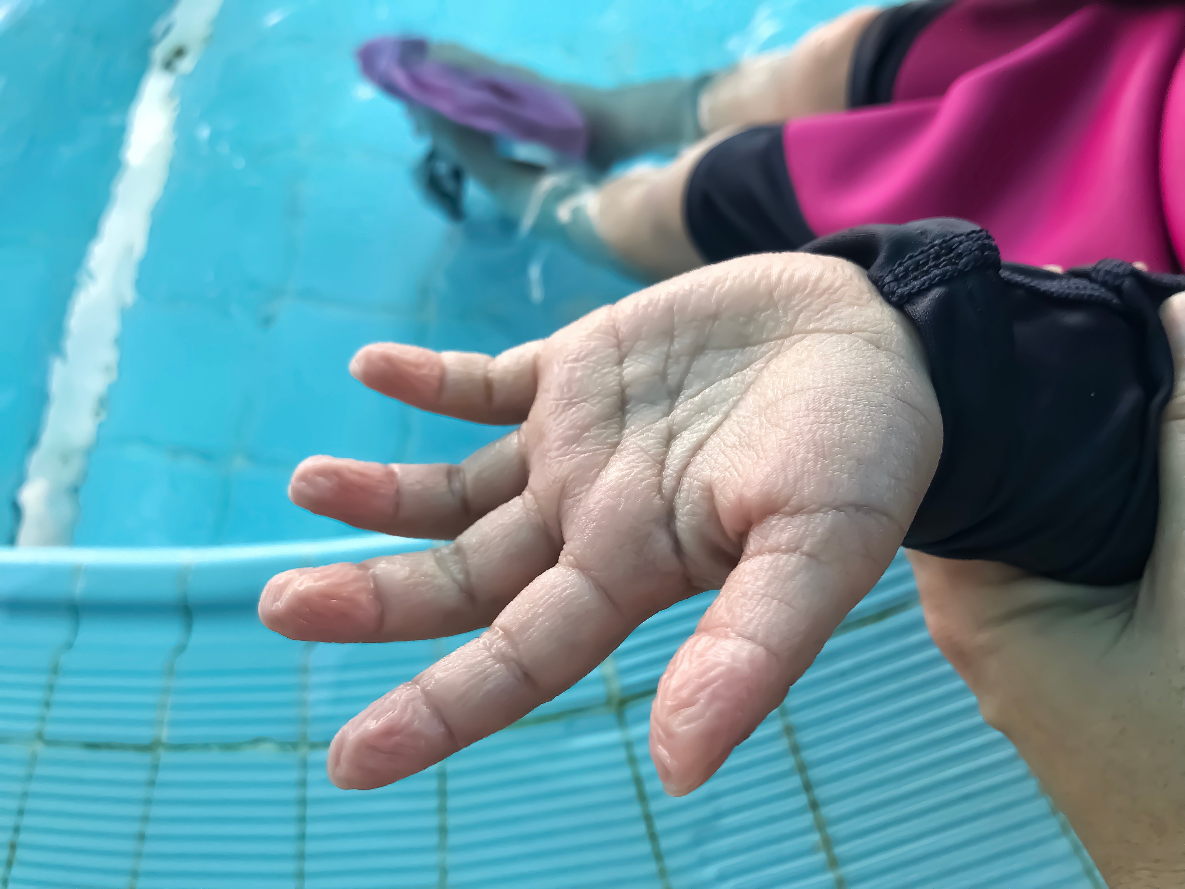 Do your hands get pruney after spending too much time in the bath or swimming pool? Photo: Shutterstock