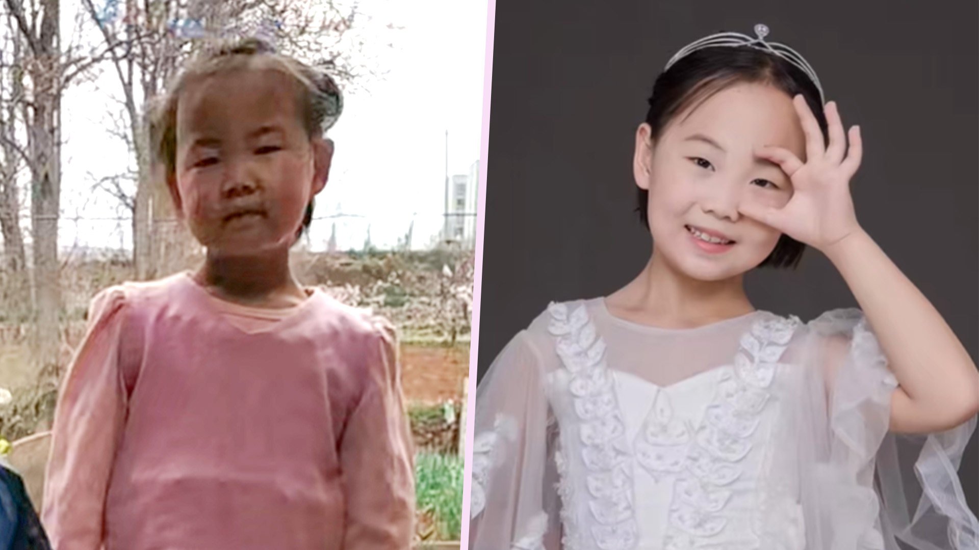 A sad and neglected little girl in China has undergone a remarkable change thanks to the love and care of her stepmother. Photo: SCMP composite/Douyin