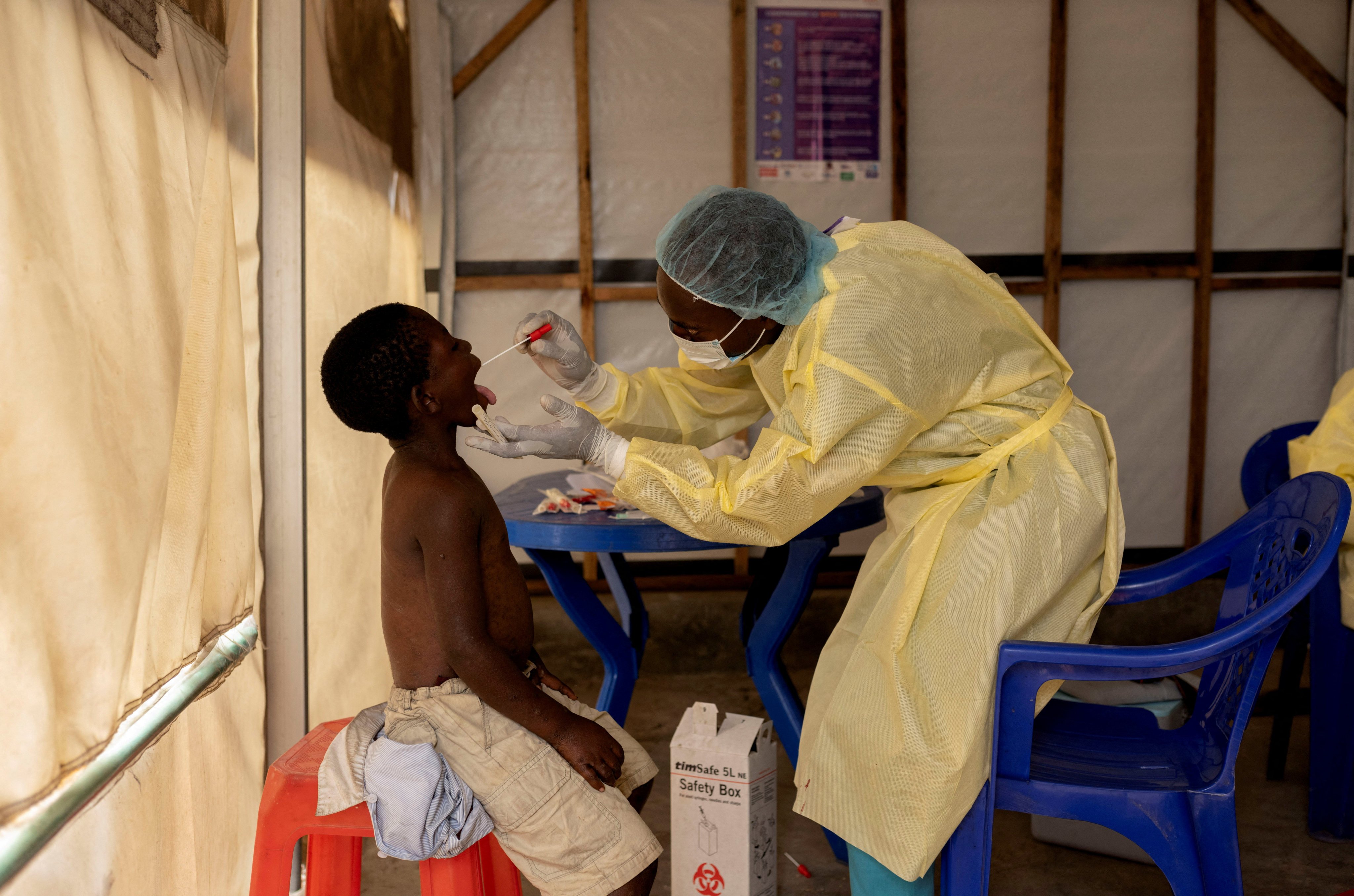 A nurse takes a sample from a child suspected to have mpox at the treatment centre in Munigi in the Democratic Republic of the Congo in July. Photo: Reuters