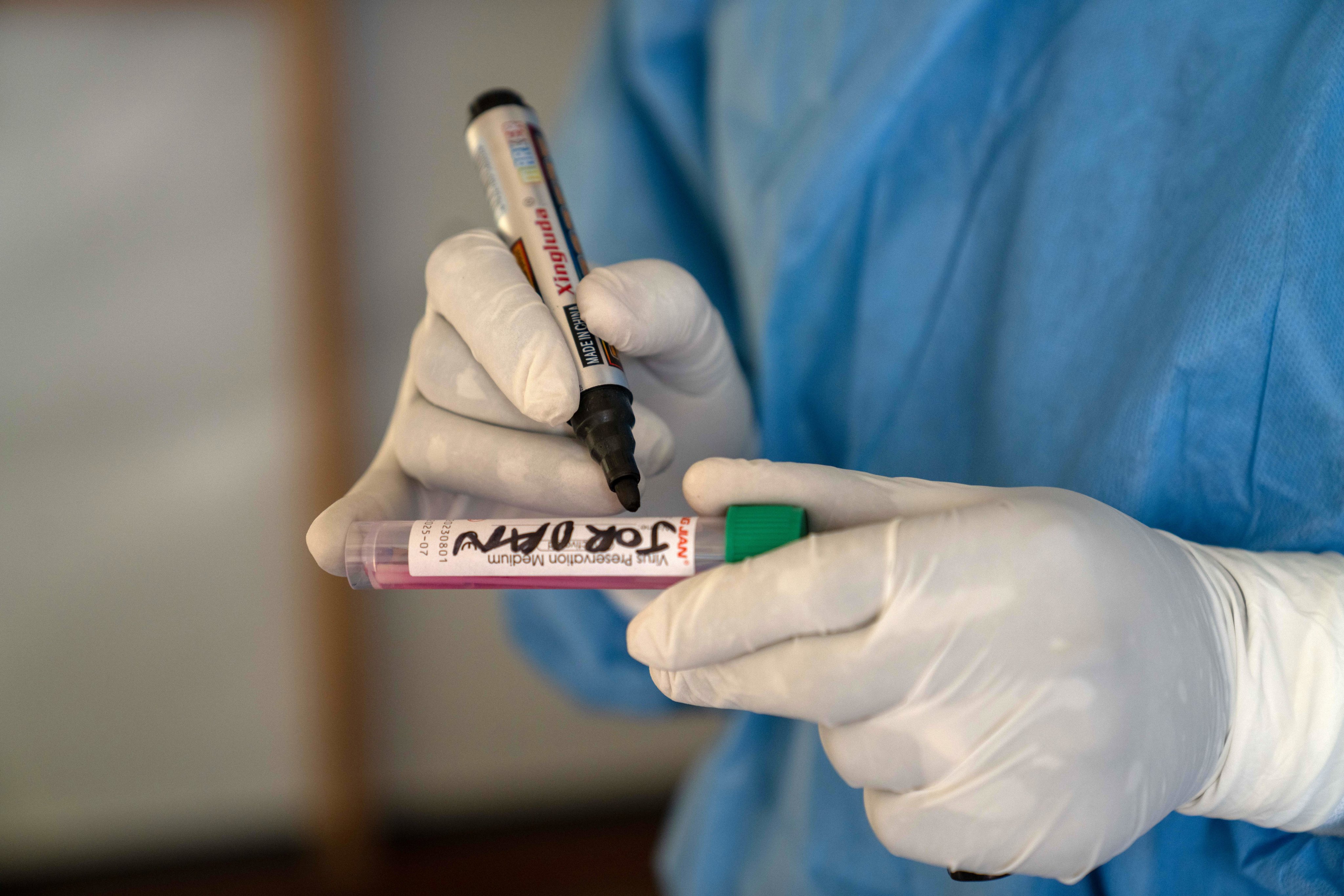 A medical staff labels an mpox sample taken from a patient in the Democratic Republic of the Congo on August 19. Photo: EPA-EFE