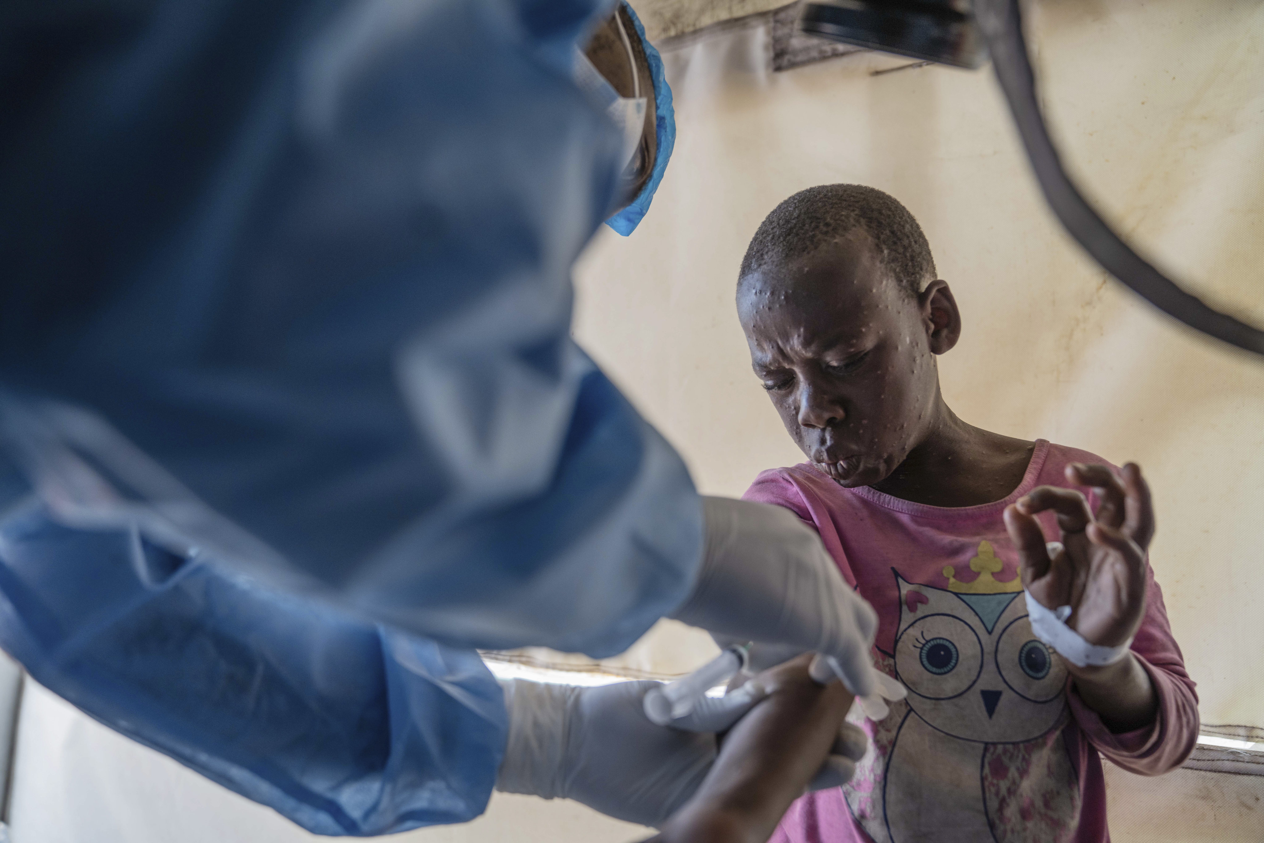 A health worker attends to a mpox patient, at a treatment centre in Munigi, eastern Congo. Photo: AP