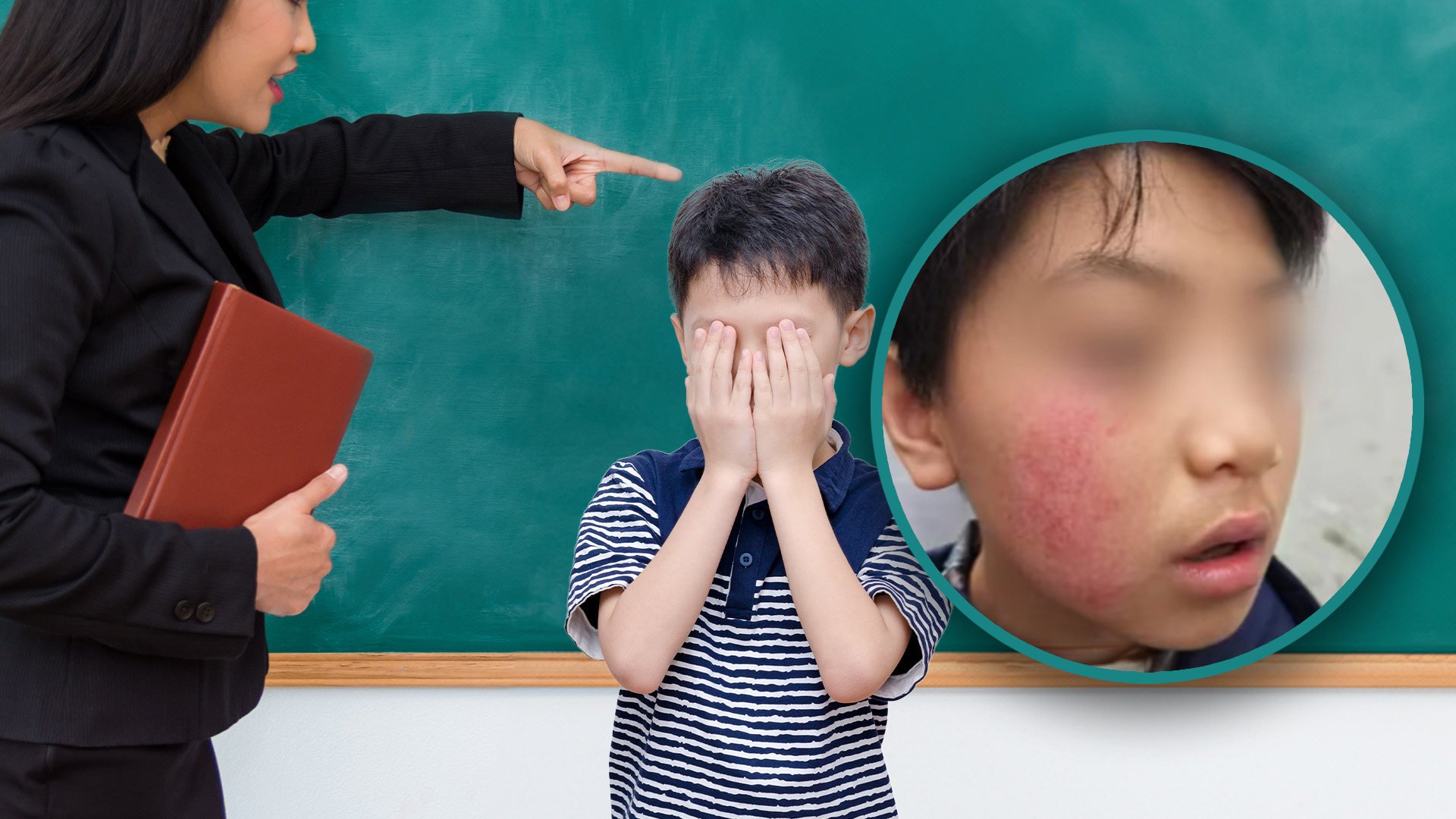 A mother in China has reported that her son experienced a loss of skin pigmentation after allegedly being slapped four times by a teacher. Photo: SCMP composite/Shutterstock/Douyin