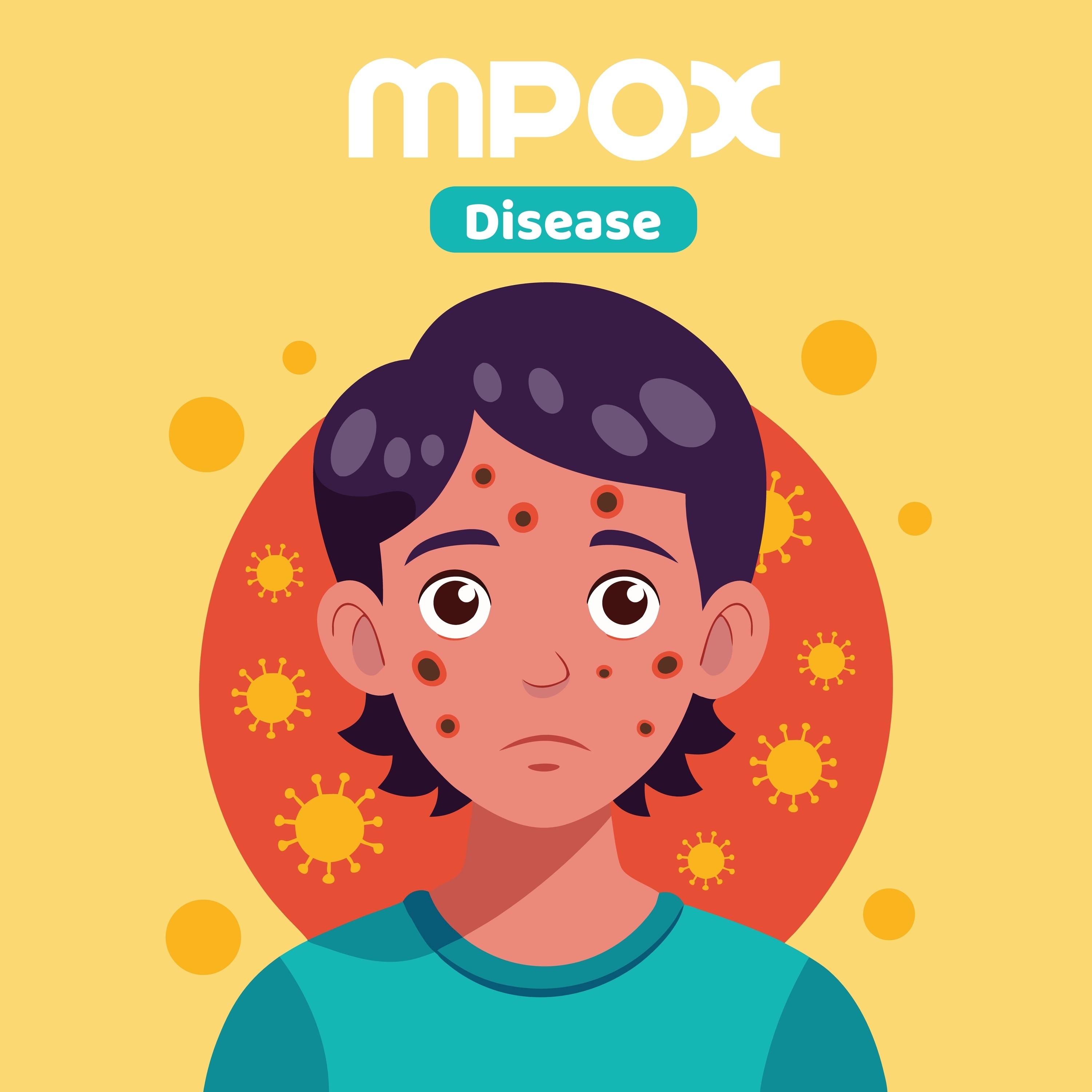 How much do you know about mpox? Photo: Shutterstock