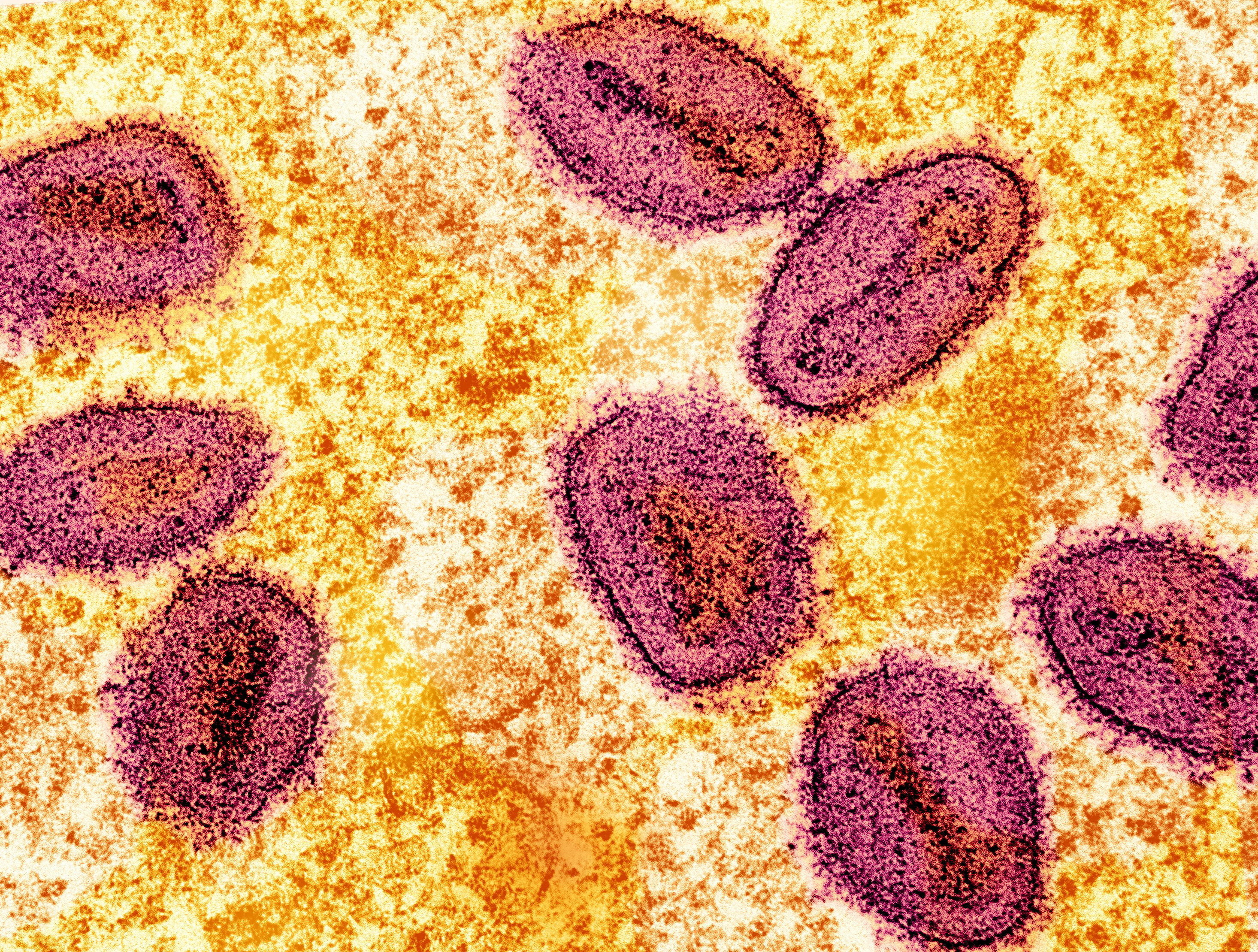 A colourized transmission electron micrograph shows mpox virus particles (pink) found within an infected cell (yellow). Image: National Institute of Allergy and Infectious Diseases via Reuters