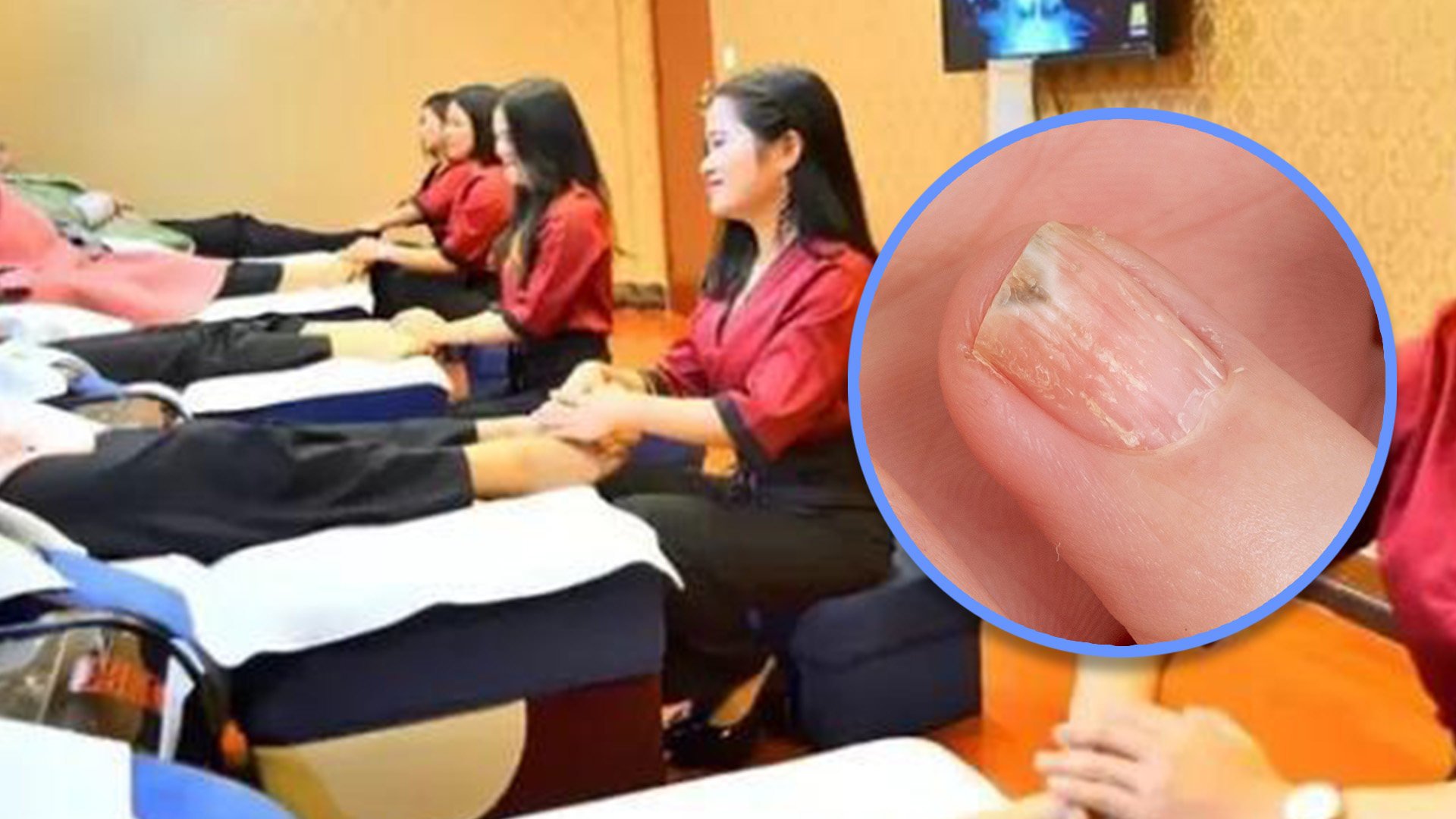 A foot massage centre in China has been ordered to compensate a four-year-old boy and his father after the youngster had to have his finger amputated following treatment for a nail infection that went wrong. Photo: SCMP composite/Shutterstock/Sohu