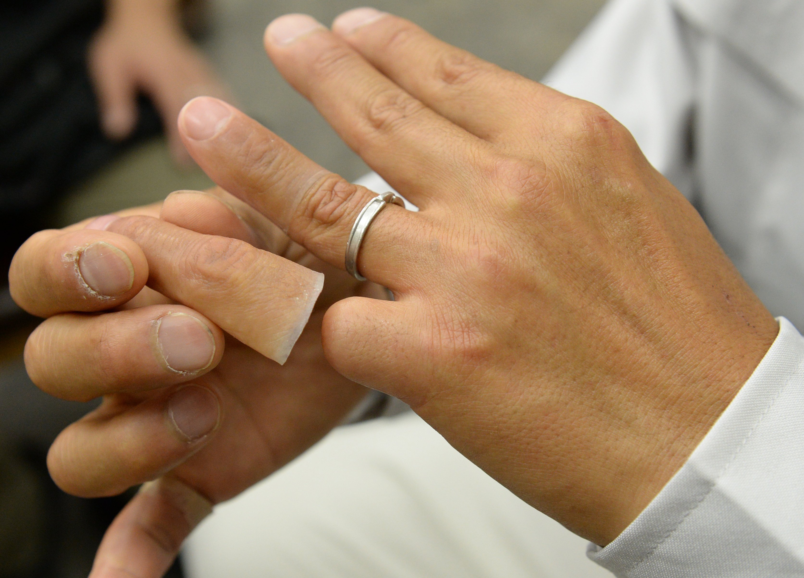 A former yakuza gangster shows off his silicone-made finger for a chopped off finger. “Yubitsume” is a ritual in Japan’s underworld whereby a yakuza amputates a part of their little finger to express a sincere apology for a transgression. Photo: AFP