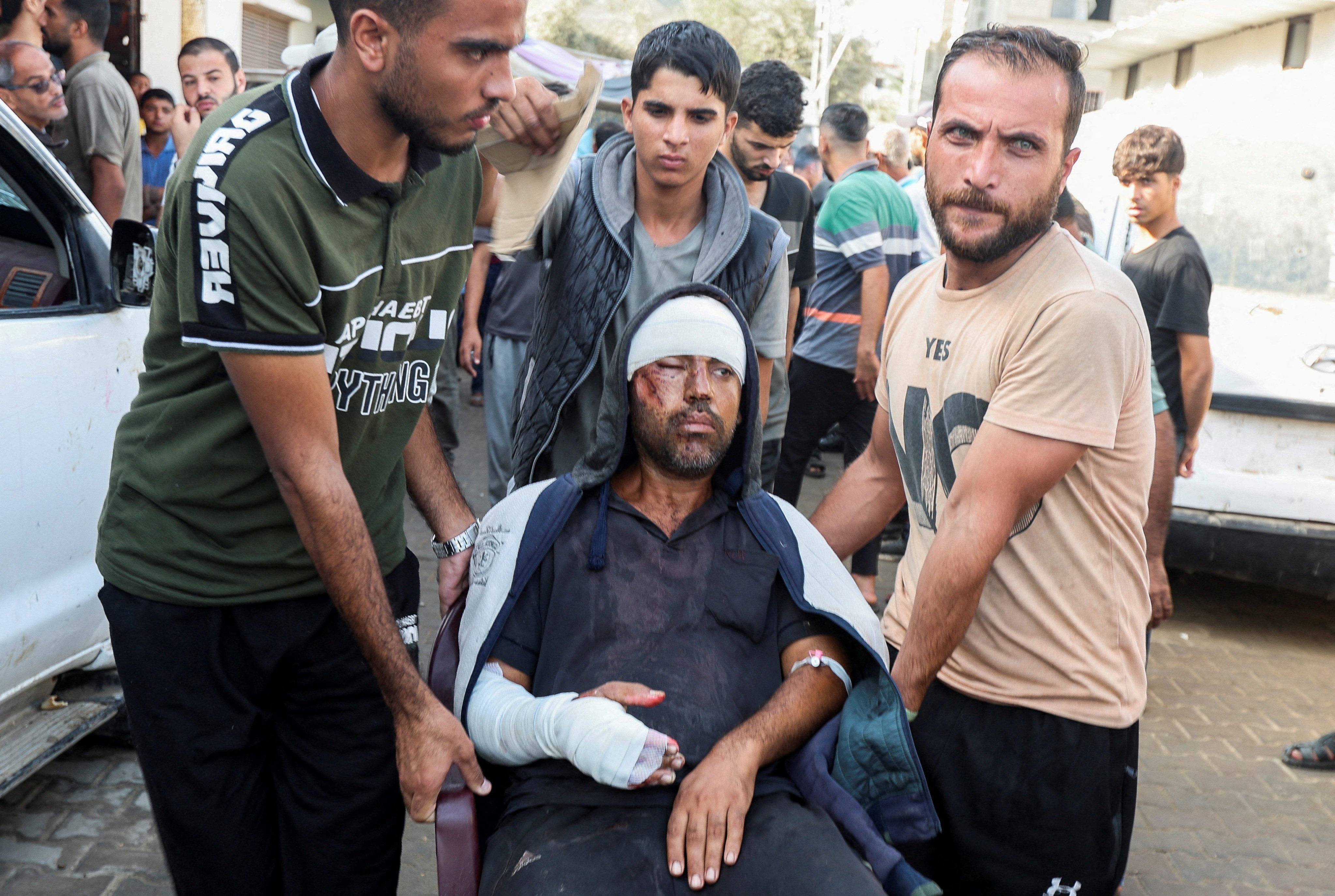 A man who was wounded in an Israeli strike on tents sheltering displaced people in central Gaza. Photo: Reuters
