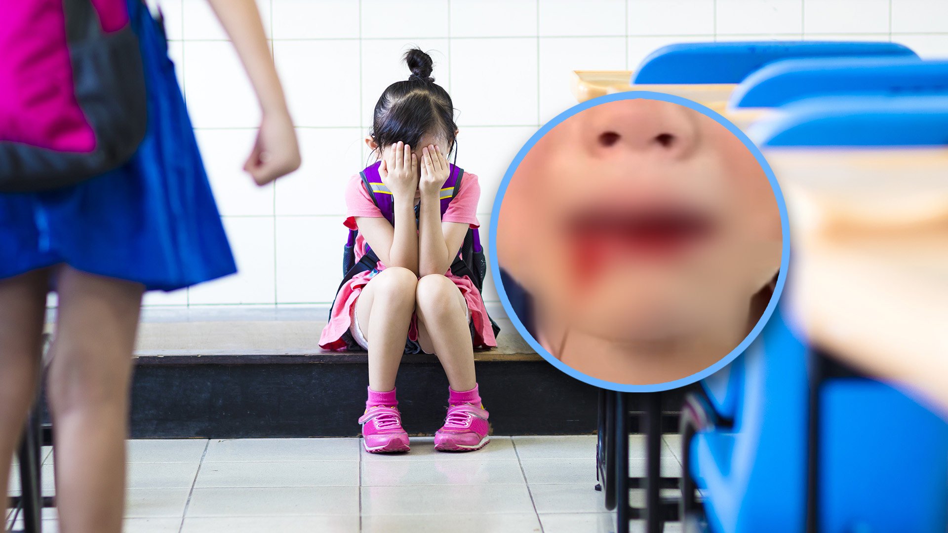 A father was criticised for sharing a video of his injured daughter, bullied at school, rather than addressing the bullies. 
Photo: SCMP composite/Shutterstock/Douyin