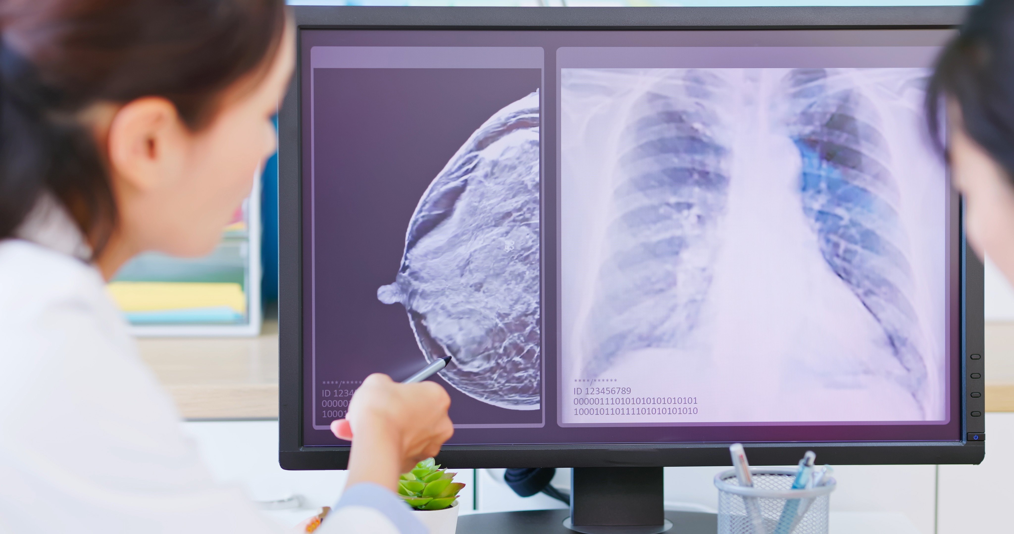 A woman is shown her mammogram test results on a computer screen. Photo: Shutterstock