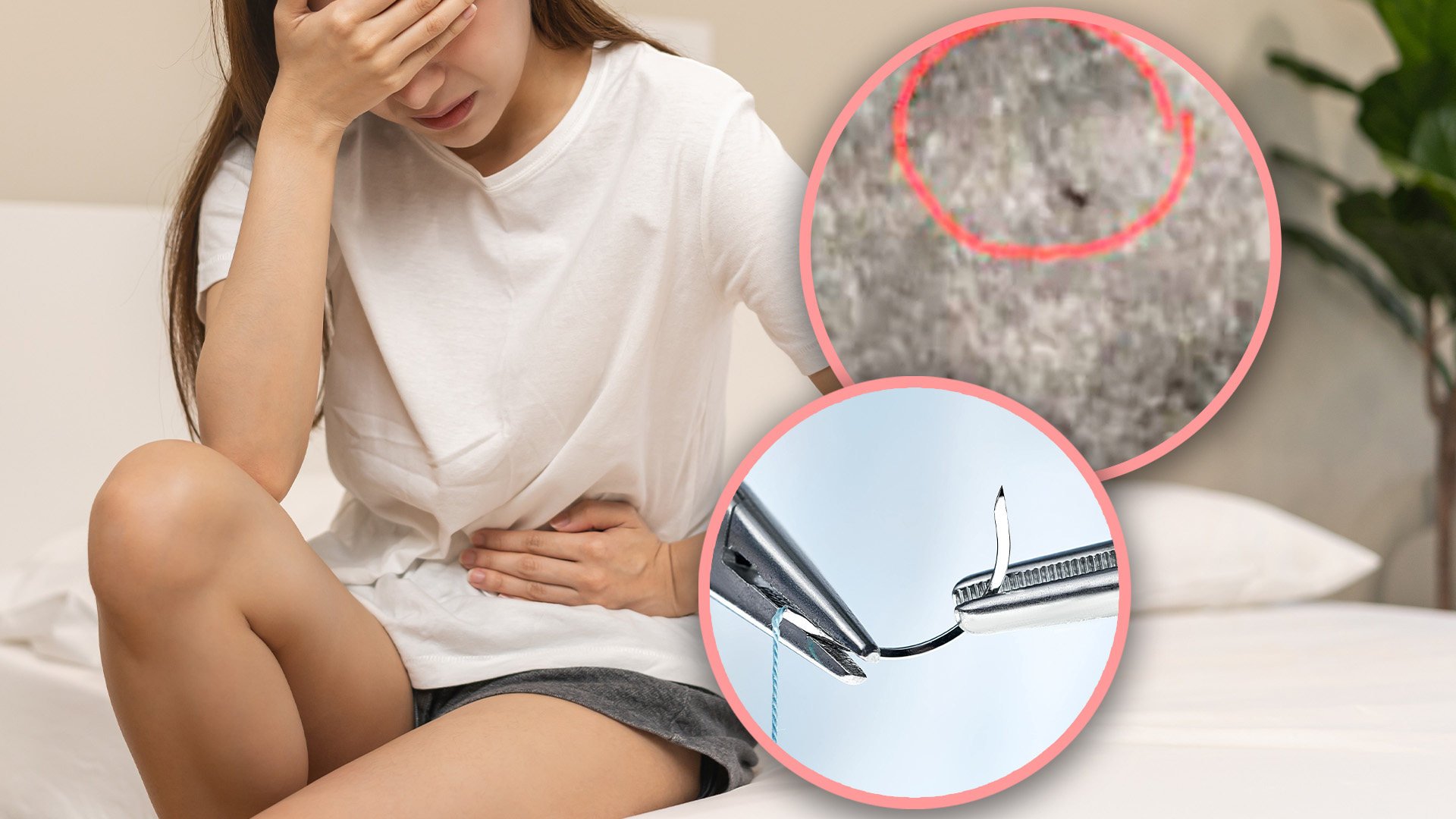 A Thai woman has gone viral on social media after revealing that a needle was accidentally left in her vagina during childbirth 18 years ago, causing her ongoing pain. Photo: SCMP composite/Shutterstock/Pavena Foundation for Children and Women