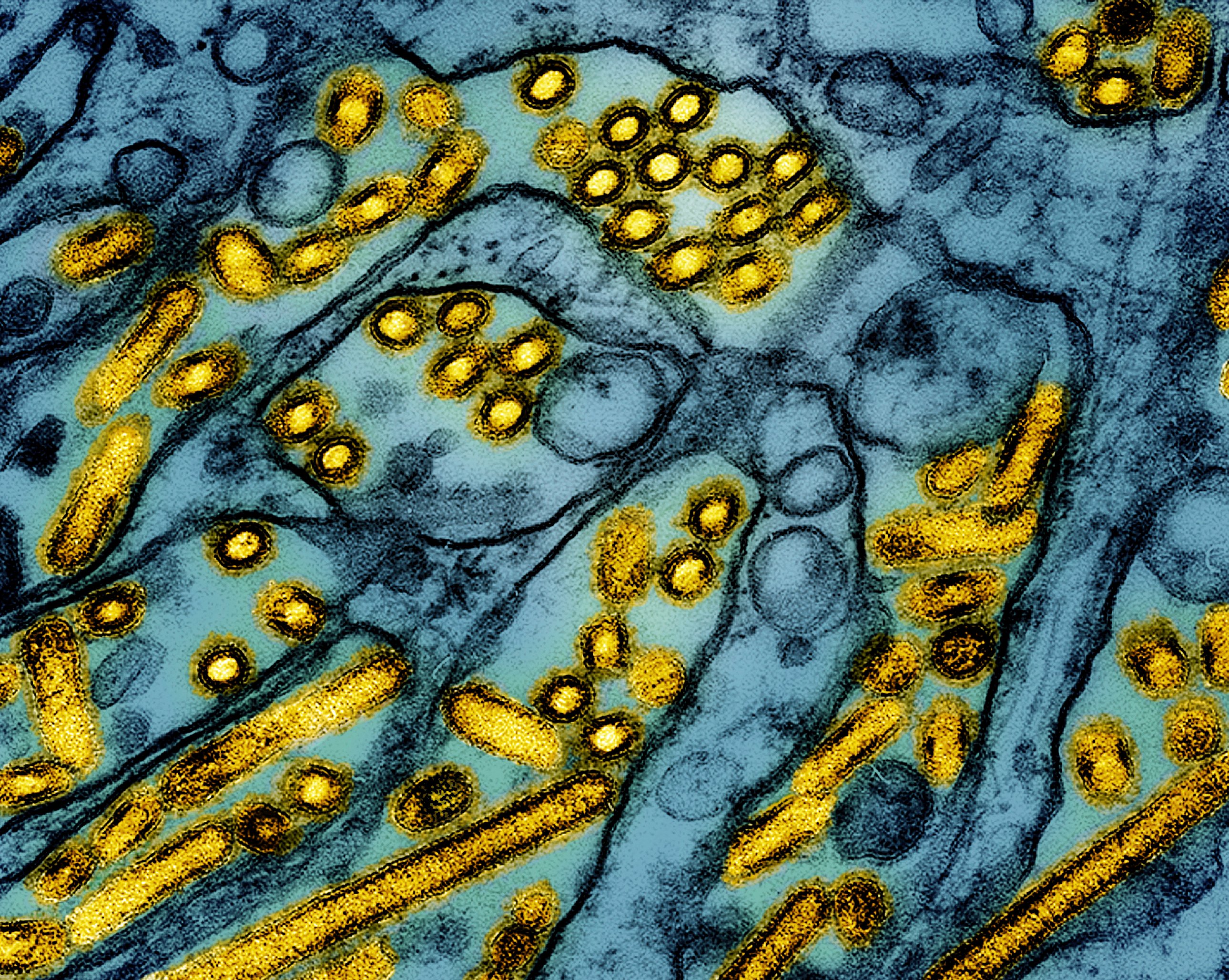 Avian influenza A H5N1 virus particles. Photo: CDC/NIAID via AP